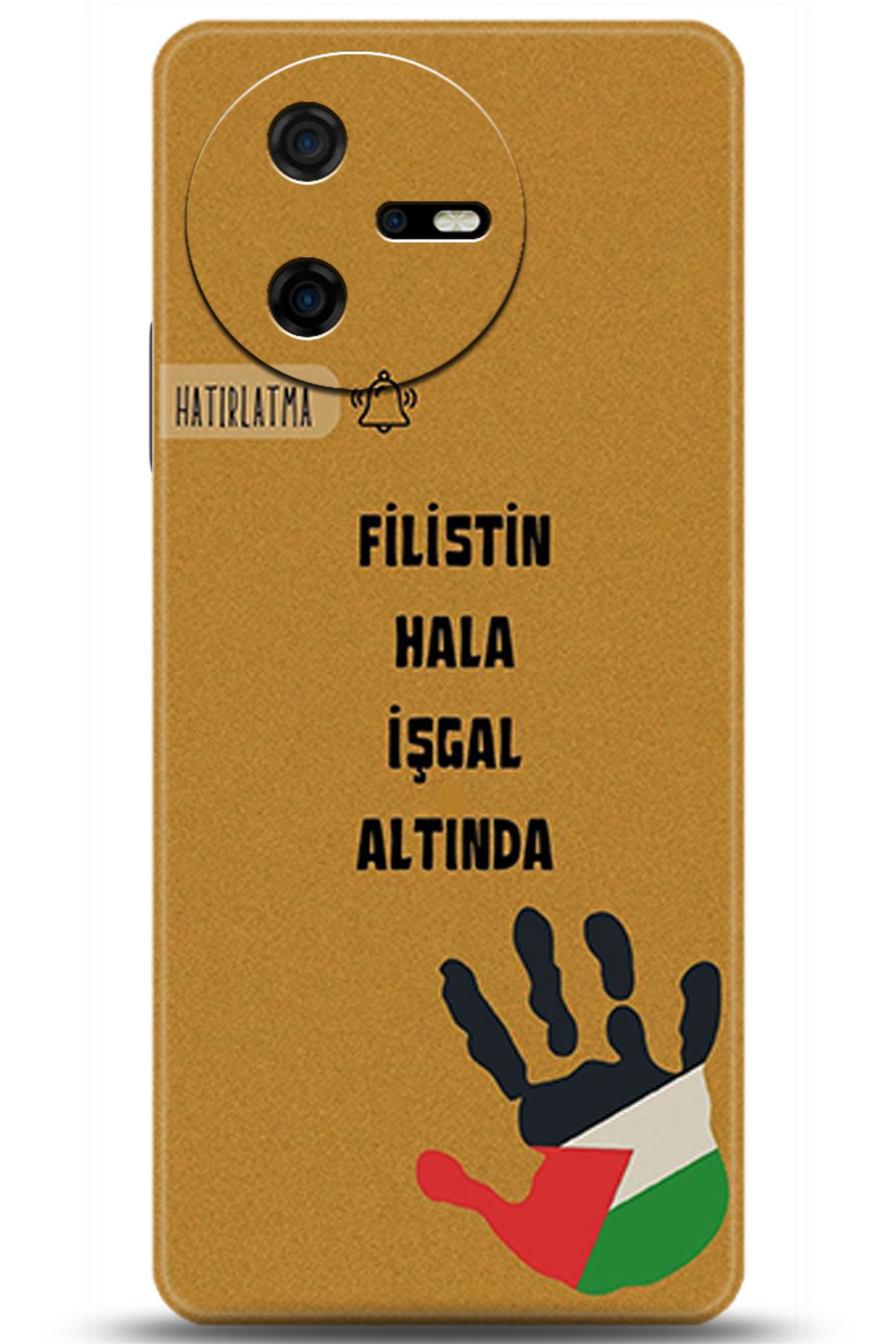 Casper Via A40 Uyumlu Kılıf HD Baskılı Kılıf - Followed Institution 5740