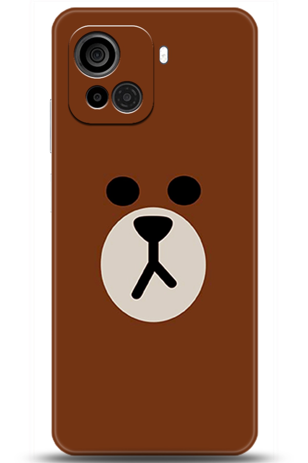 Casper Via F30 Uyumlu Kılıf HD Baskılı Kılıf - Followed Institution 5430