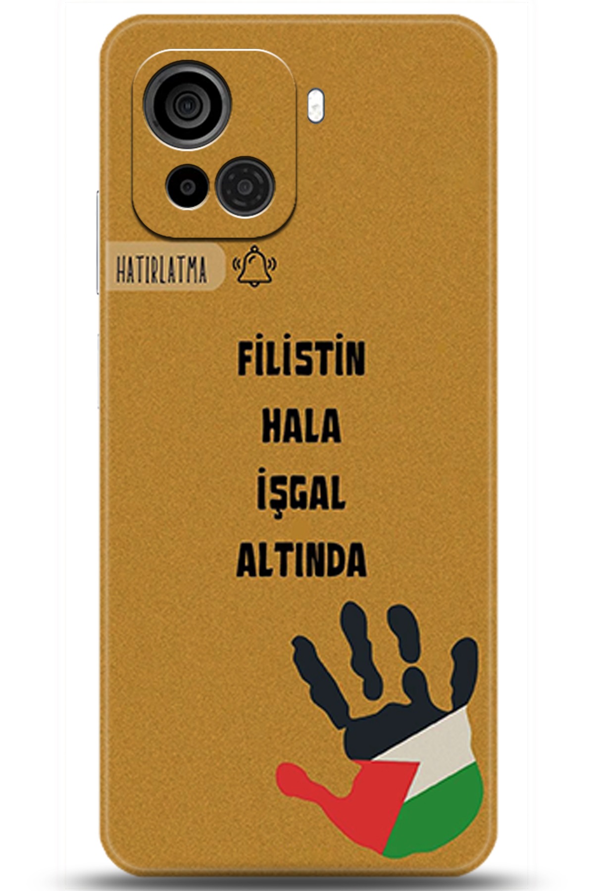 Casper Via F30 Uyumlu Kılıf HD Baskılı Kılıf - Followed Institution 5740