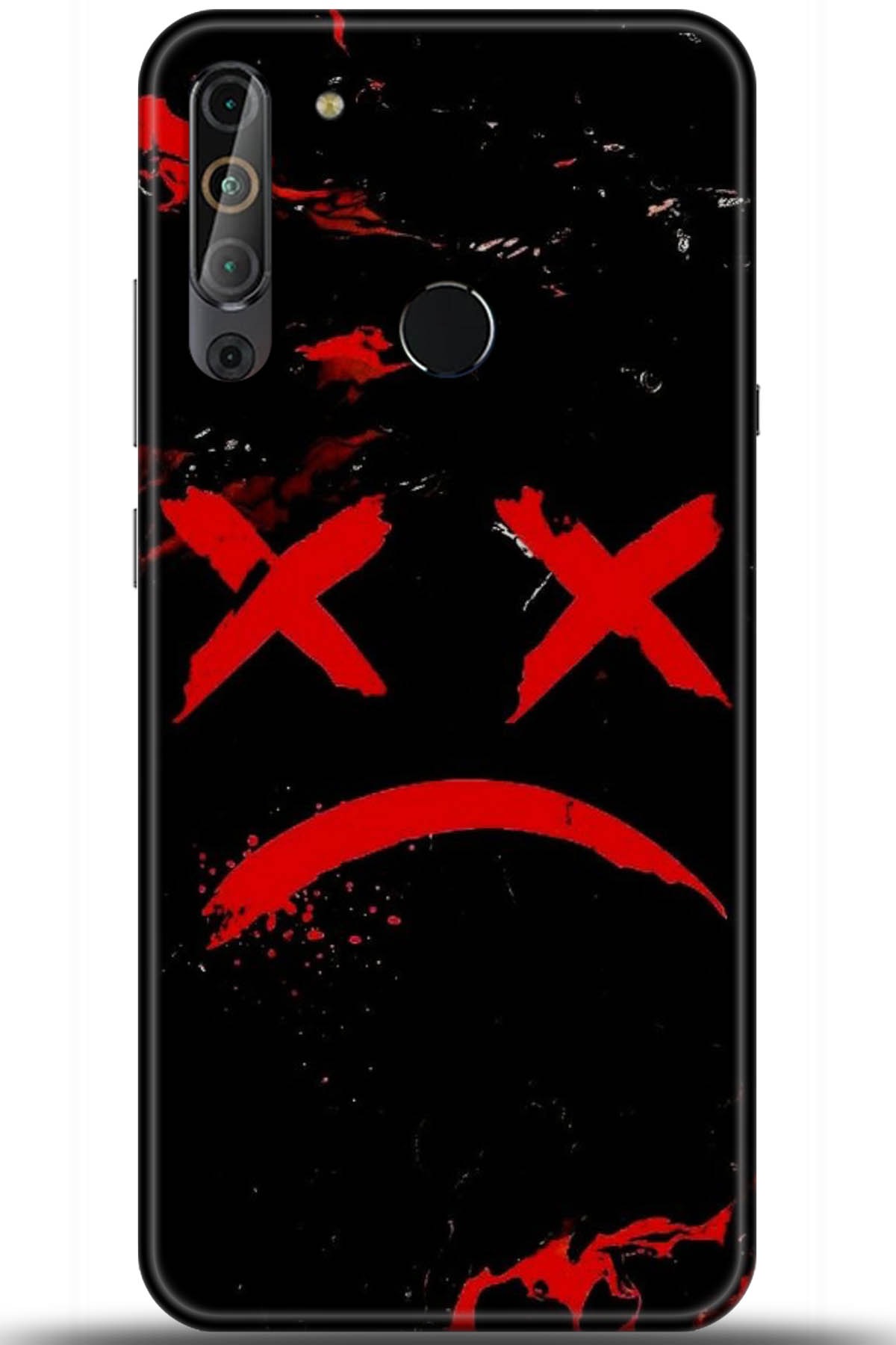 Casper Via X20 Uyumlu Kılıf HD Baskılı Kılıf - Followed Institution 5139