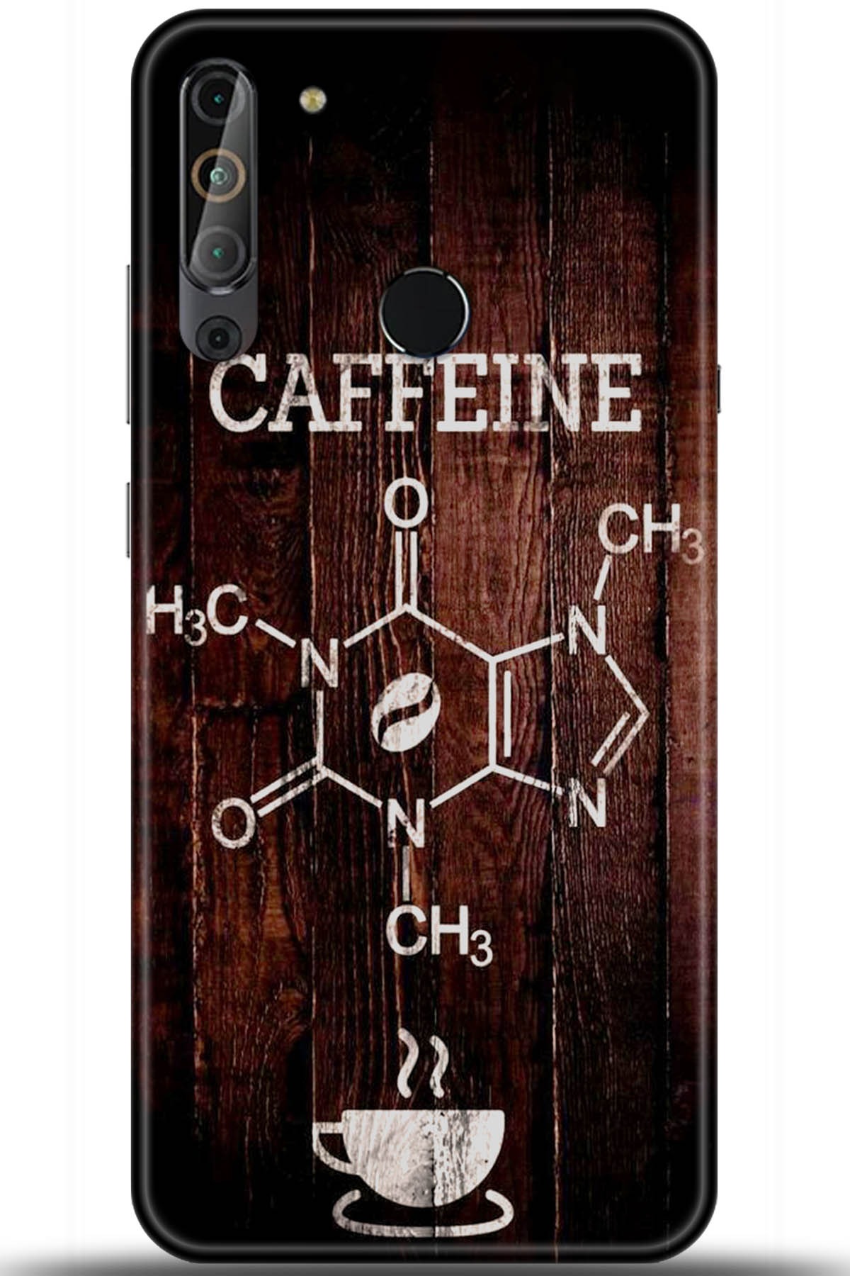 Casper Via X20 Uyumlu Kılıf HD Baskılı Kılıf - Followed Institution 5501