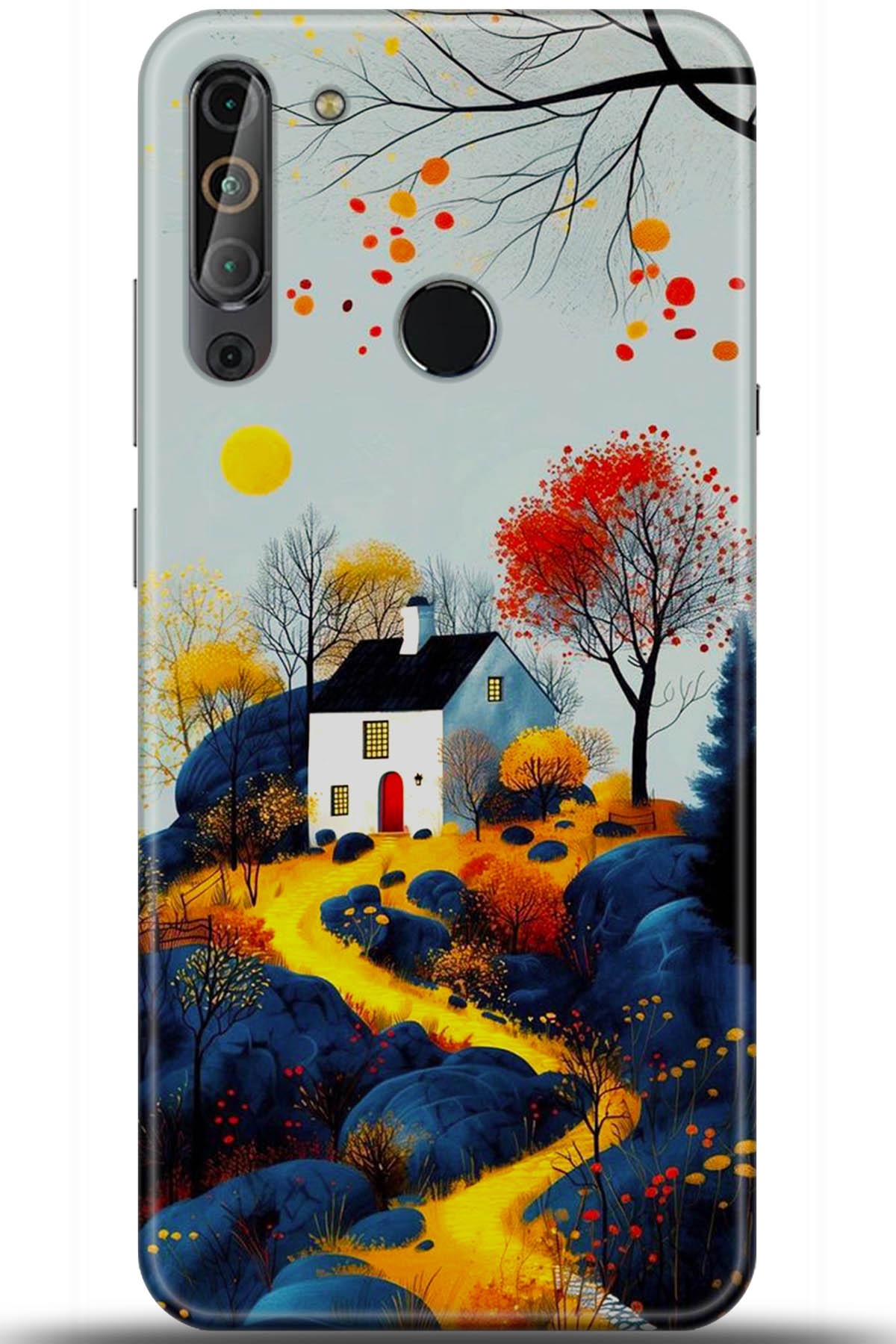 Casper Via X20 Uyumlu Kılıf HD Baskılı Kılıf - Followed Institution 5569