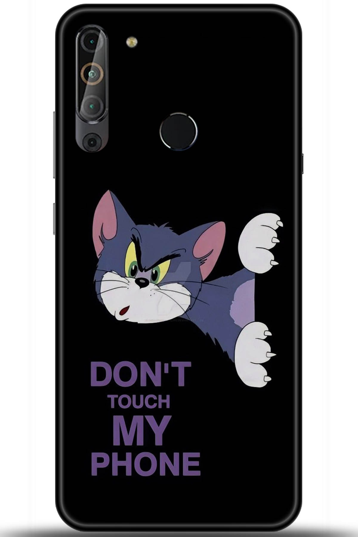 Casper Via X20 Uyumlu Kılıf HD Baskılı Kılıf - Followed Institution 5755