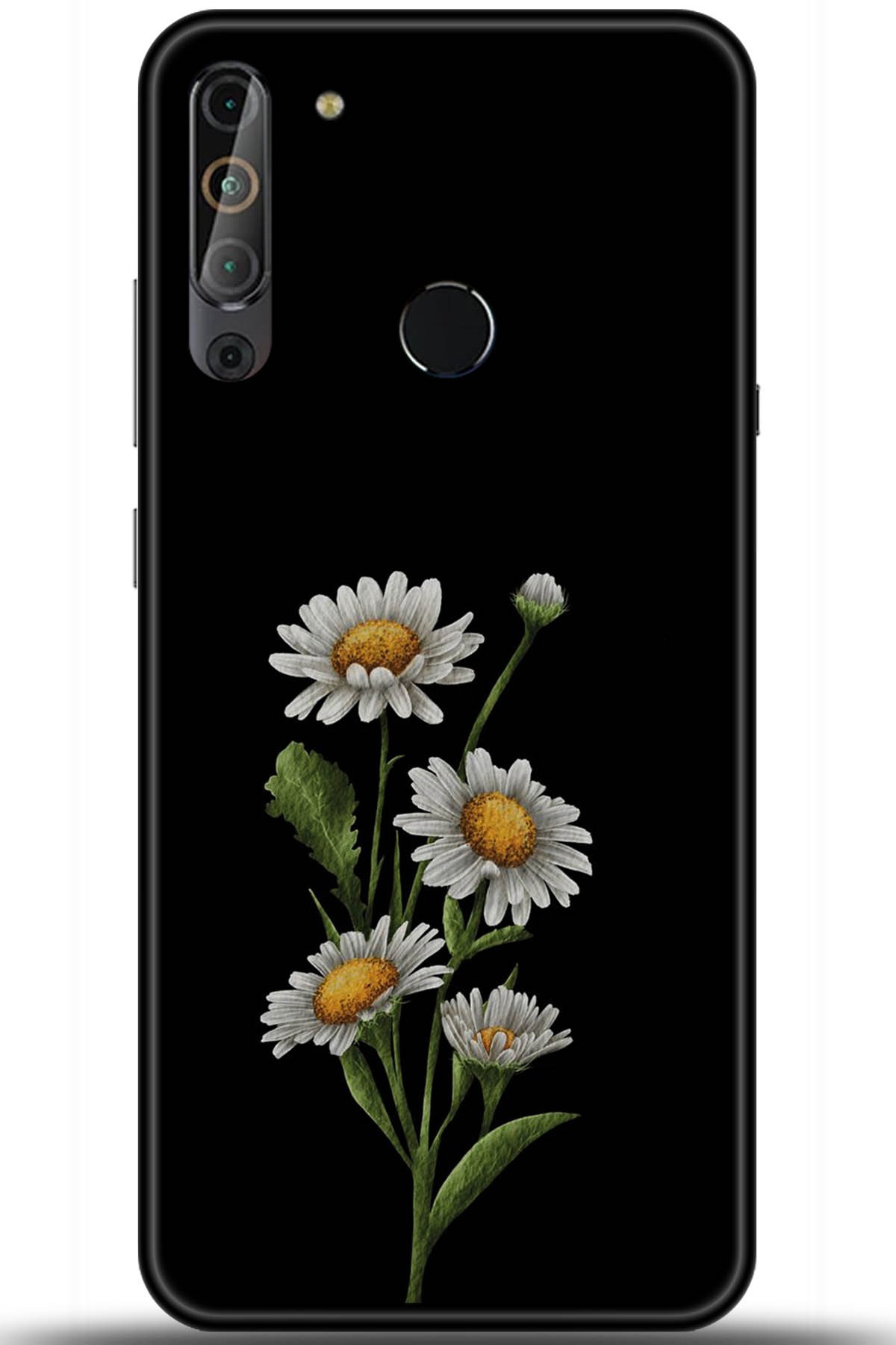 Casper Via X20 Uyumlu Kılıf HD Baskılı Kılıf - Followed Institution 5756