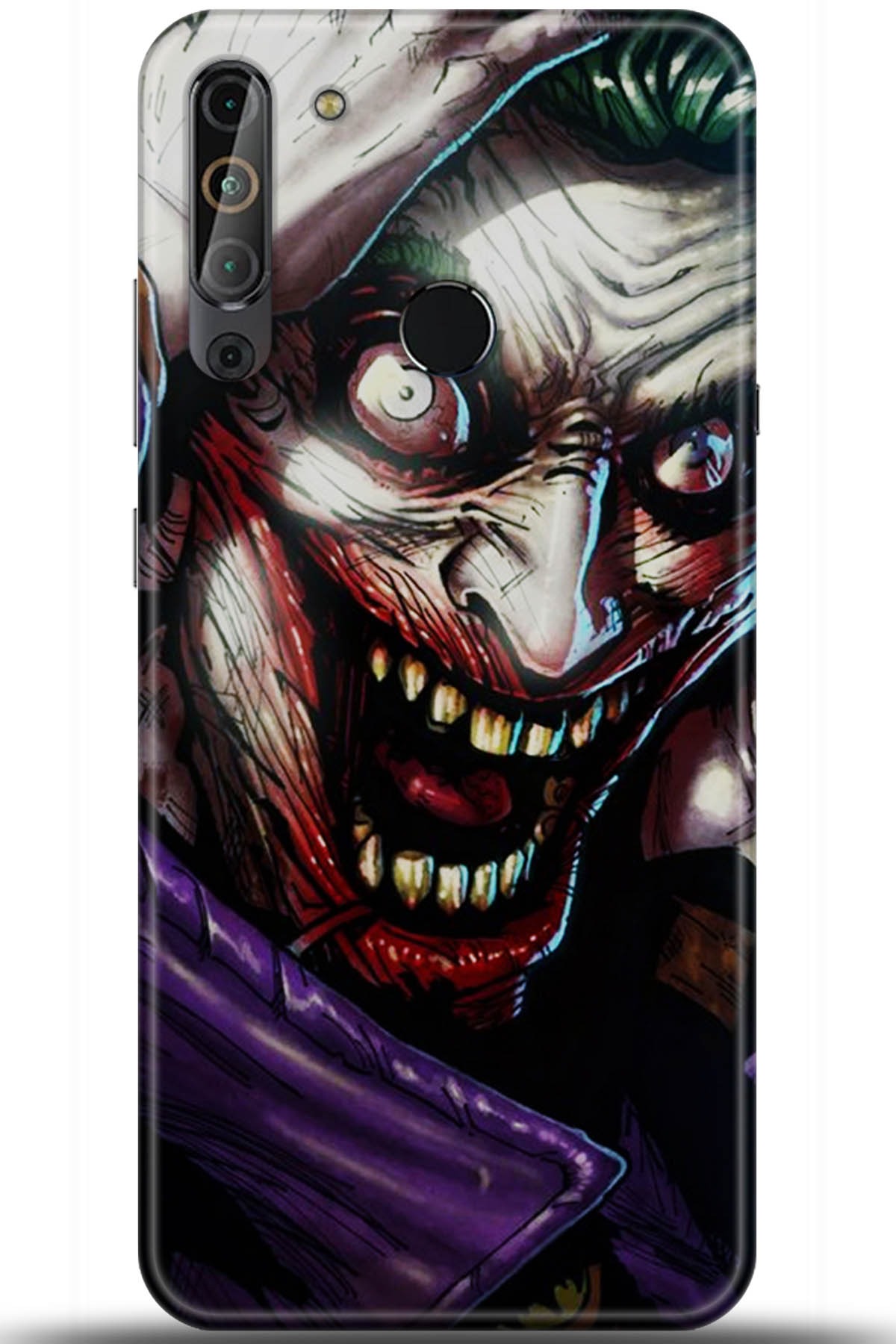 Casper Via X20 Uyumlu Kılıf HD Baskılı Kılıf - Followed Institution 5974