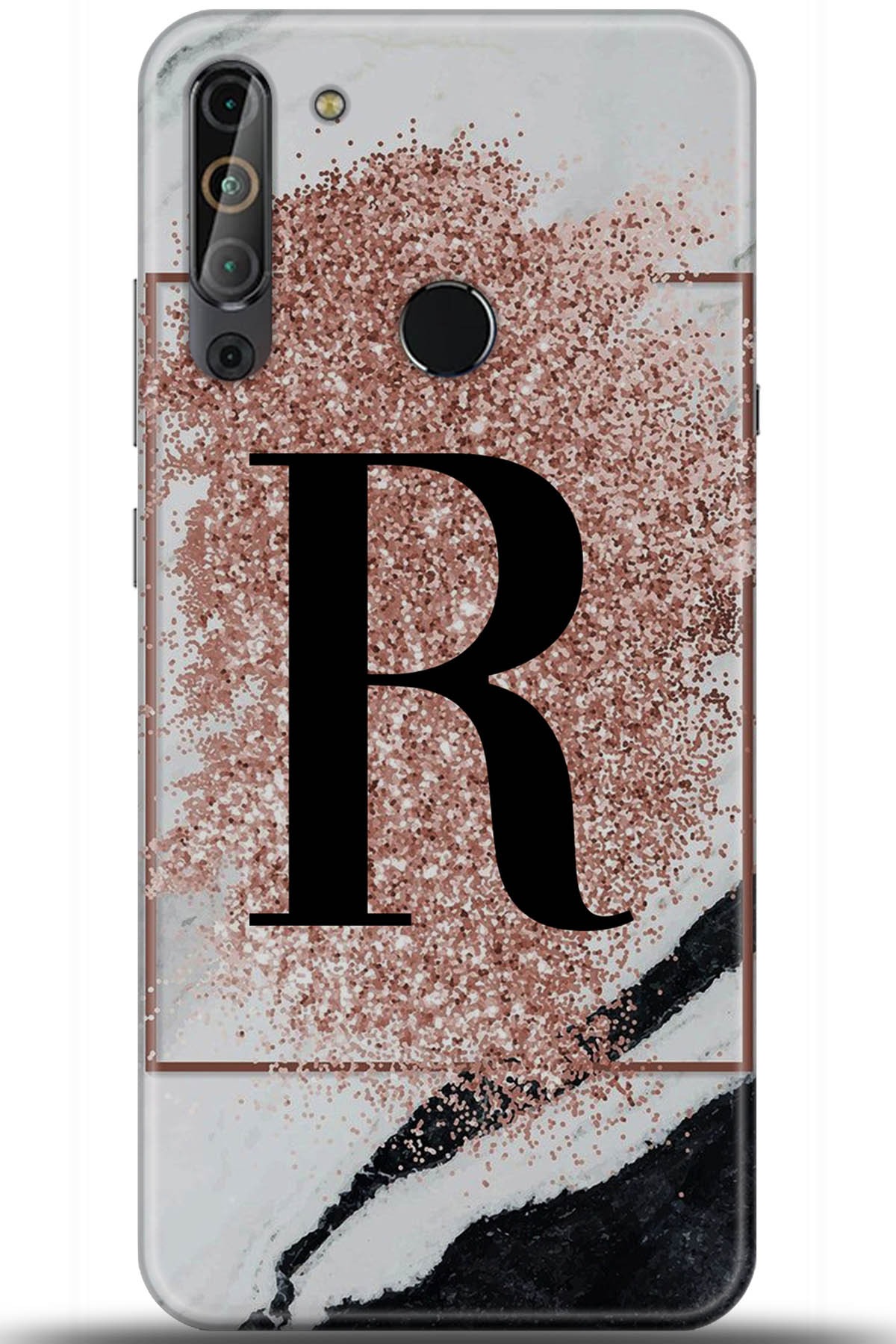 Casper Via X20 Uyumlu Kılıf HD Baskılı Kılıf - Followed Institution 6001