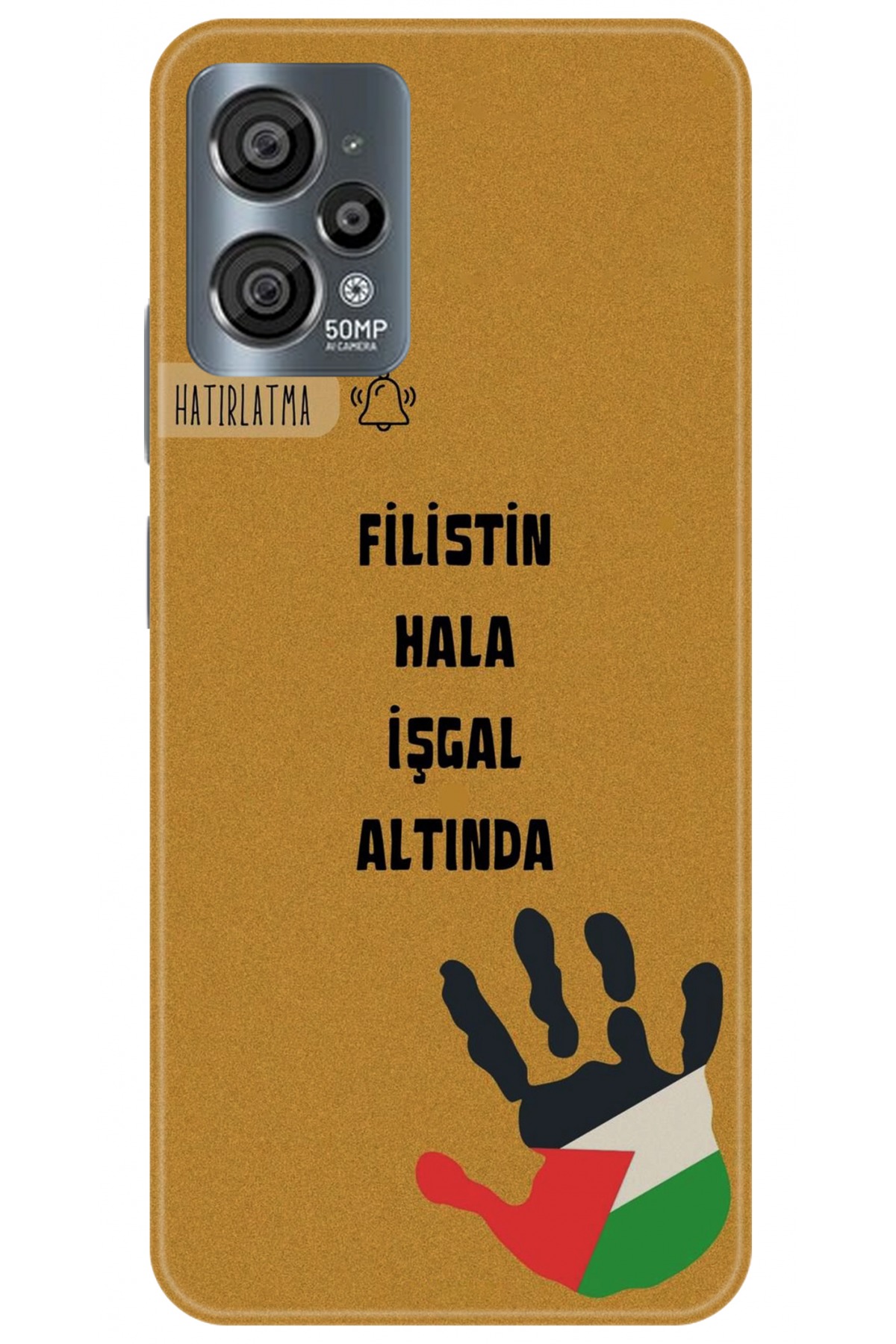 Casper Via X30 Uyumlu Kılıf HD Baskılı Kılıf - Followed Institution 5740