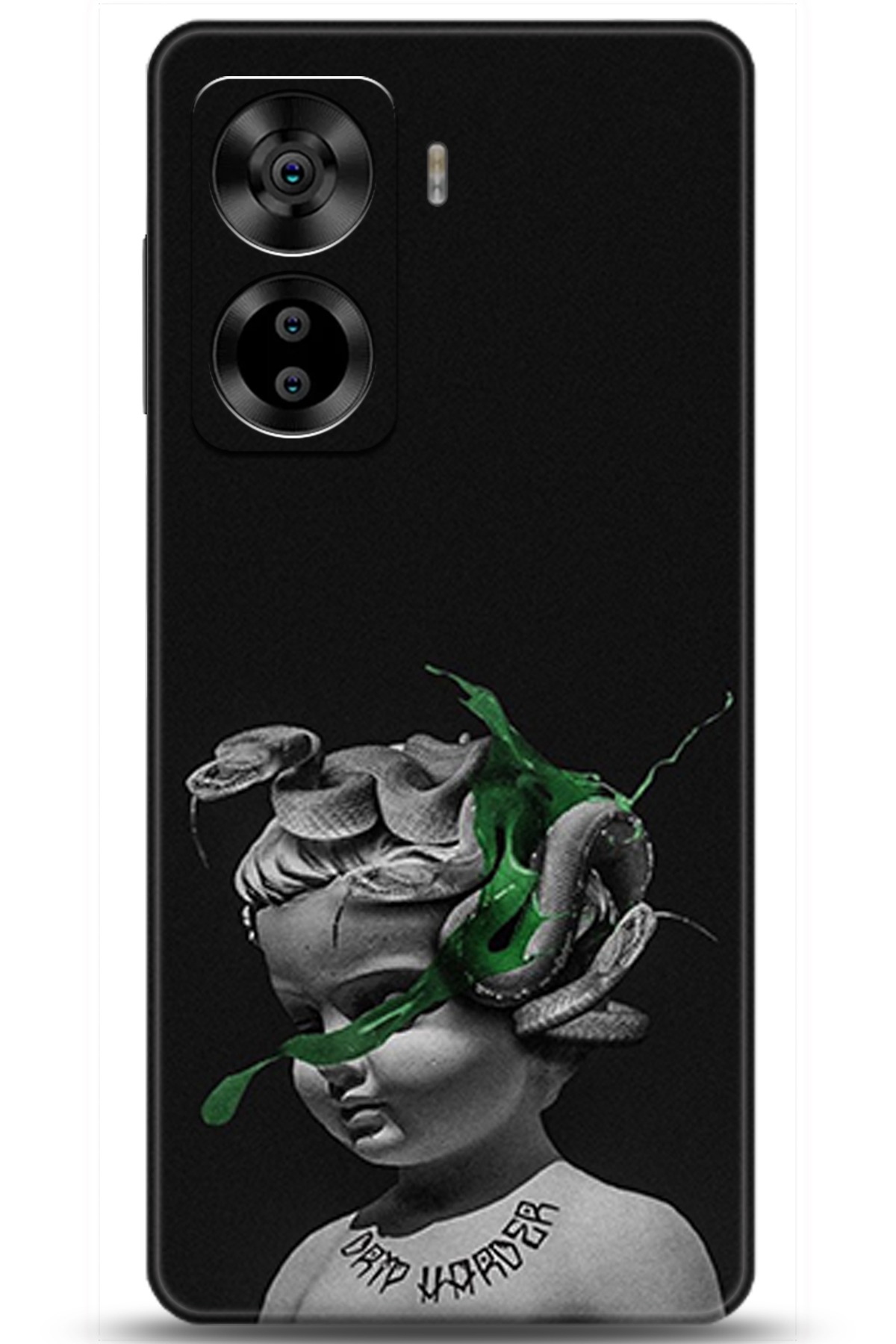 Casper Via X40 Uyumlu Kılıf HD Baskılı Kılıf - Followed Institution 5077