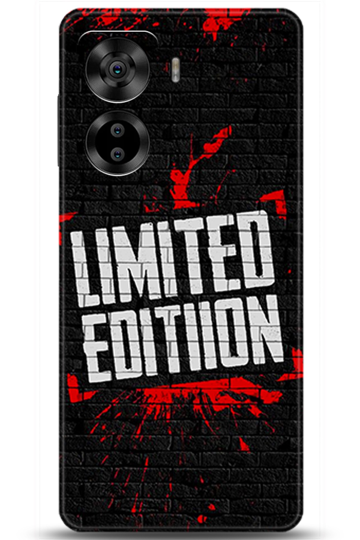 Casper Via X40 Uyumlu Kılıf HD Baskılı Kılıf - Followed Institution 5454