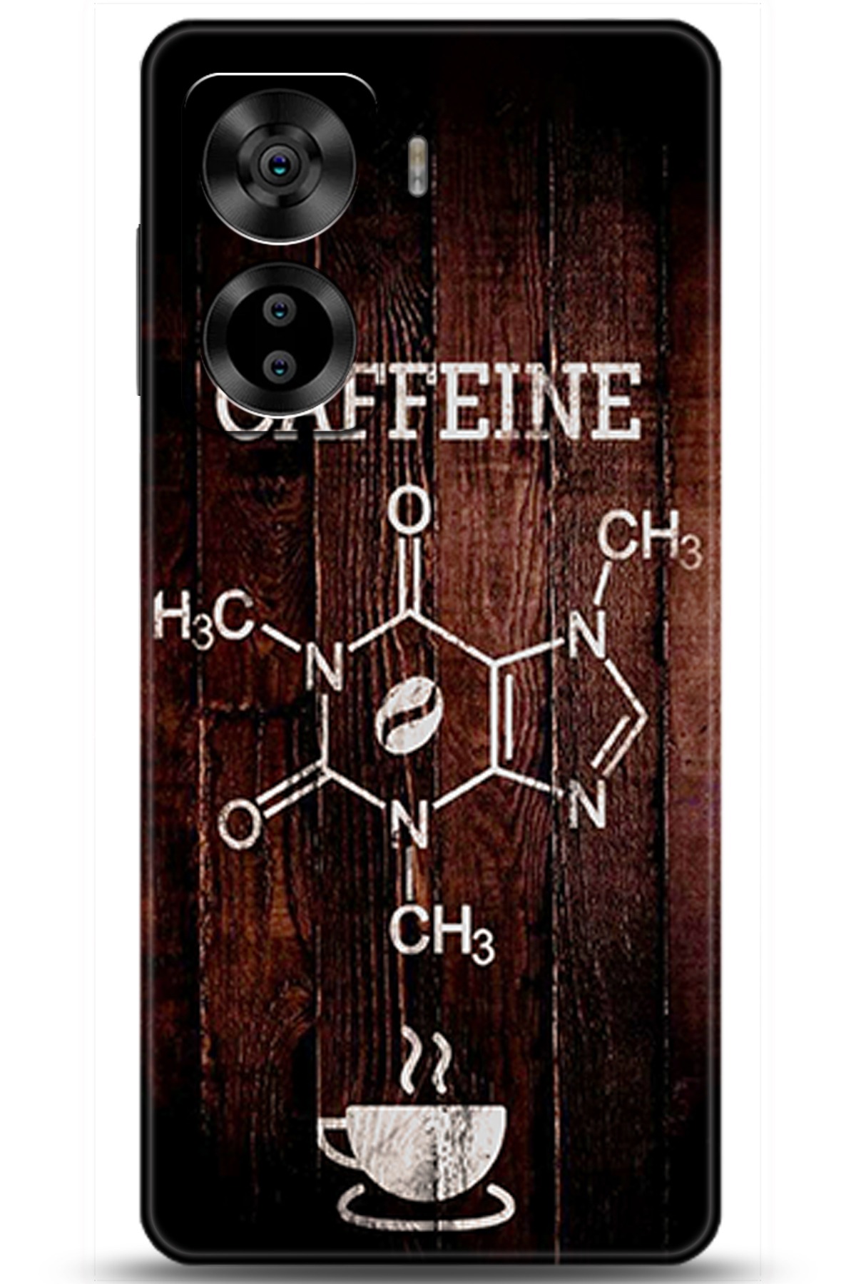 Casper Via X40 Uyumlu Kılıf HD Baskılı Kılıf - Followed Institution 5501