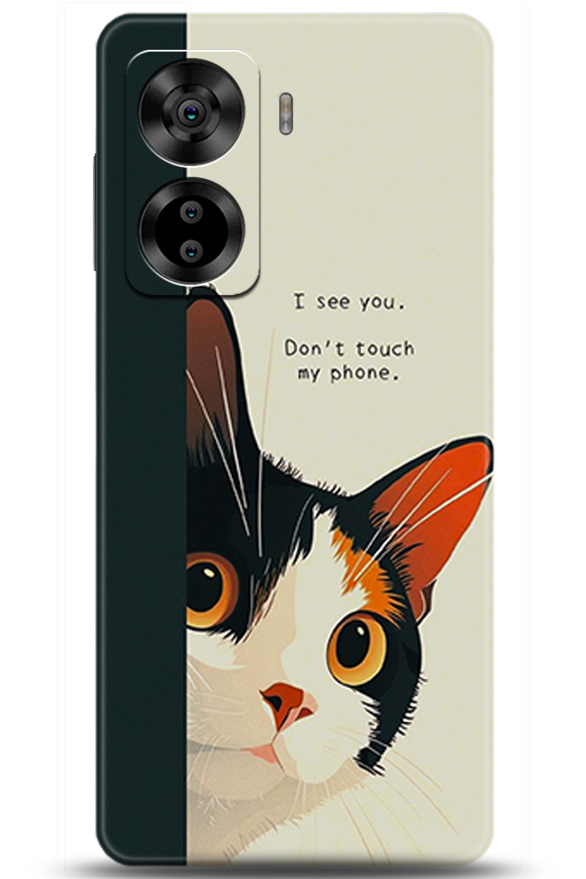 Casper Via X40 Uyumlu Kılıf HD Baskılı Kılıf - Followed Institution 5649