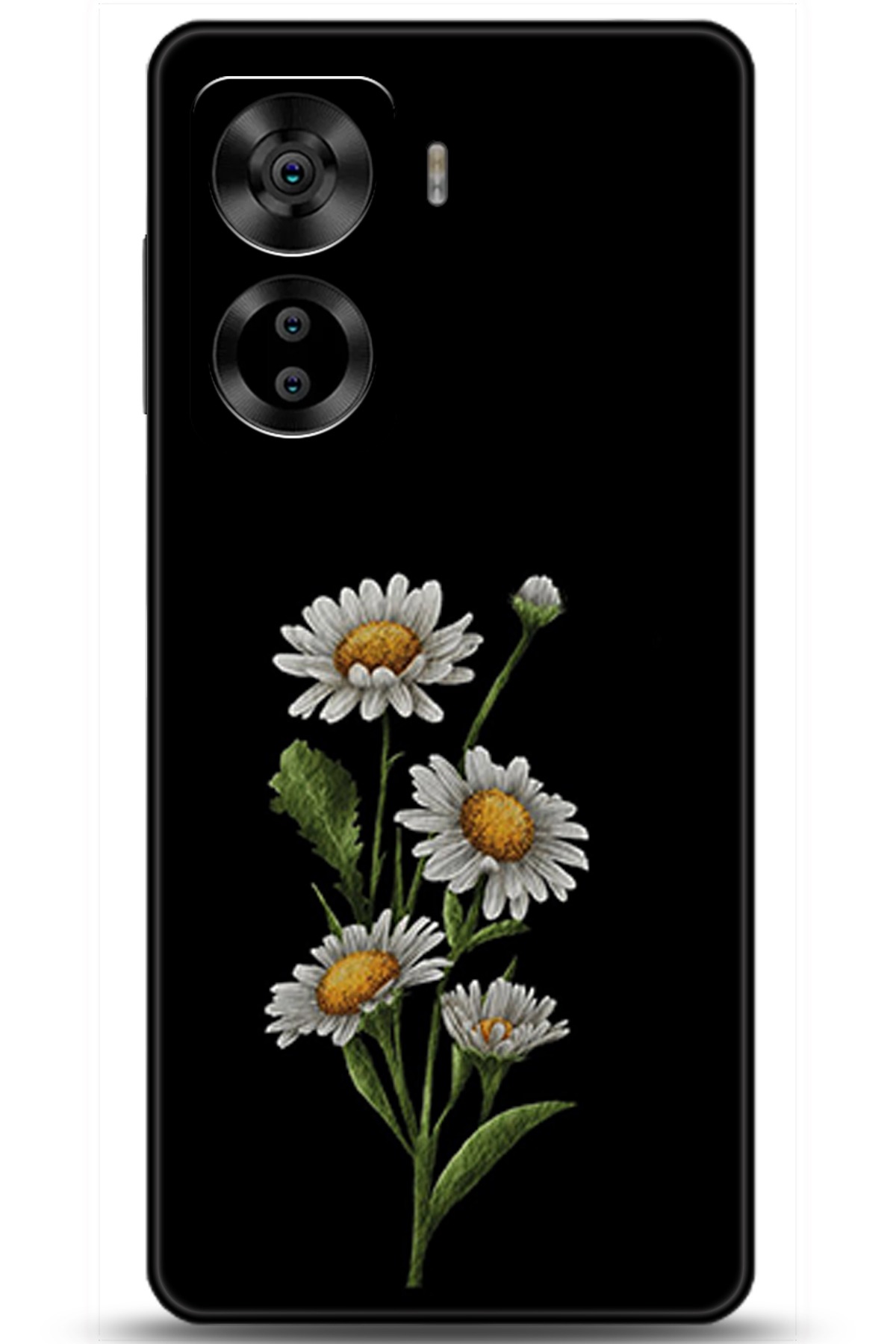 Casper Via X40 Uyumlu Kılıf HD Baskılı Kılıf - Followed Institution 5756