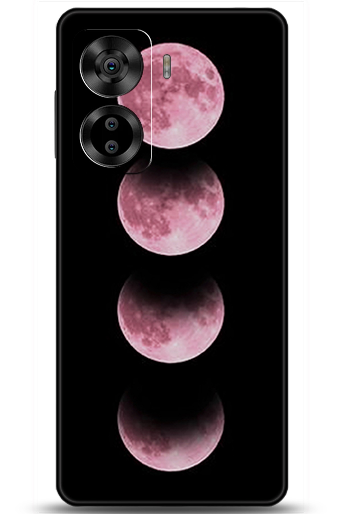 Casper Via X40 Uyumlu Kılıf HD Baskılı Kılıf - Followed Institution 5915