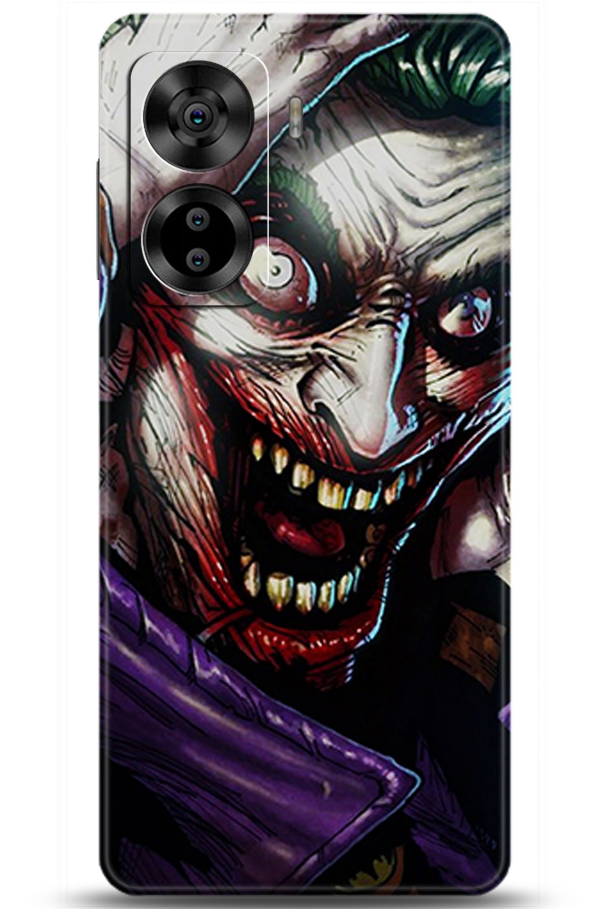 Casper Via X40 Uyumlu Kılıf HD Baskılı Kılıf - Followed Institution 5974