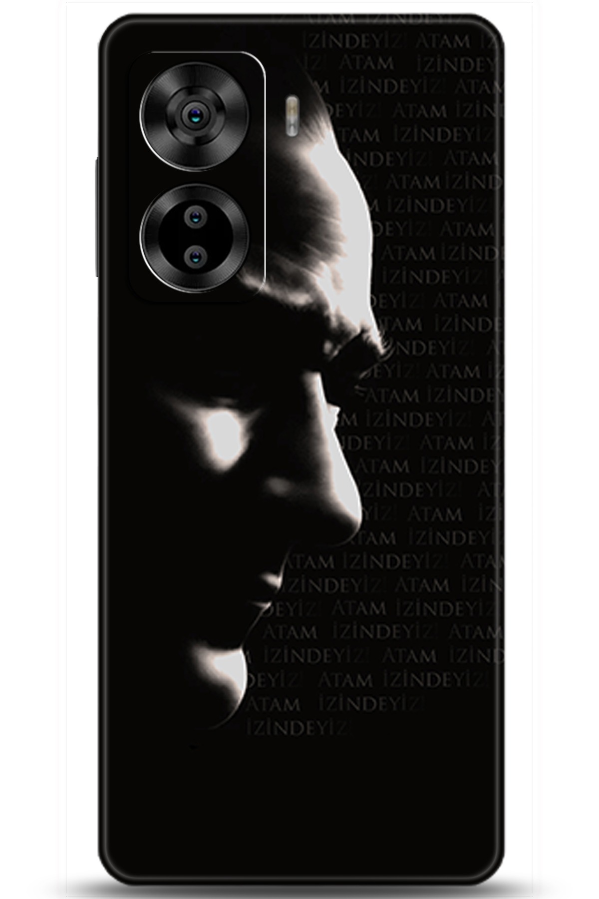 Casper Via X40 Uyumlu Kılıf HD Baskılı Kılıf - Followed Institution 5992