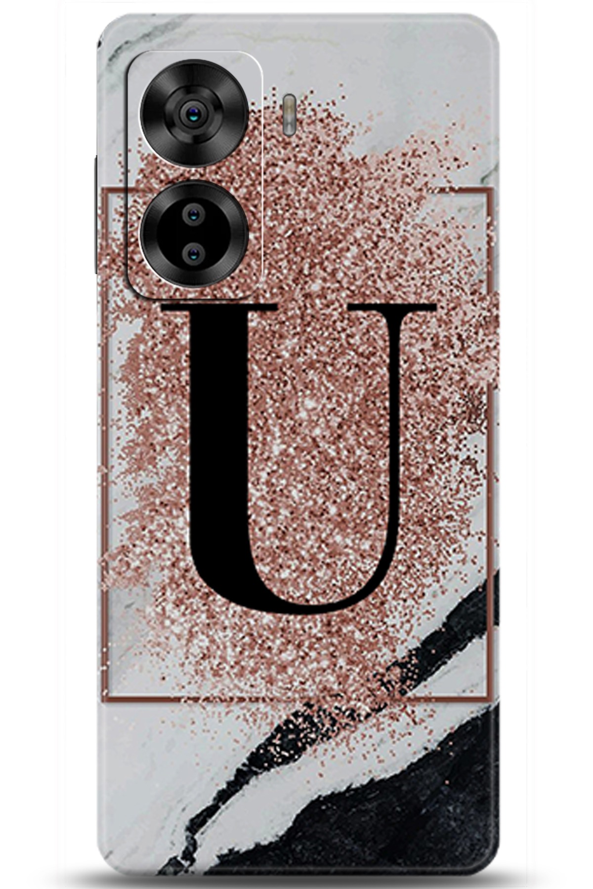 Casper Via X40 Uyumlu Kılıf HD Baskılı Kılıf - Followed Institution 5997