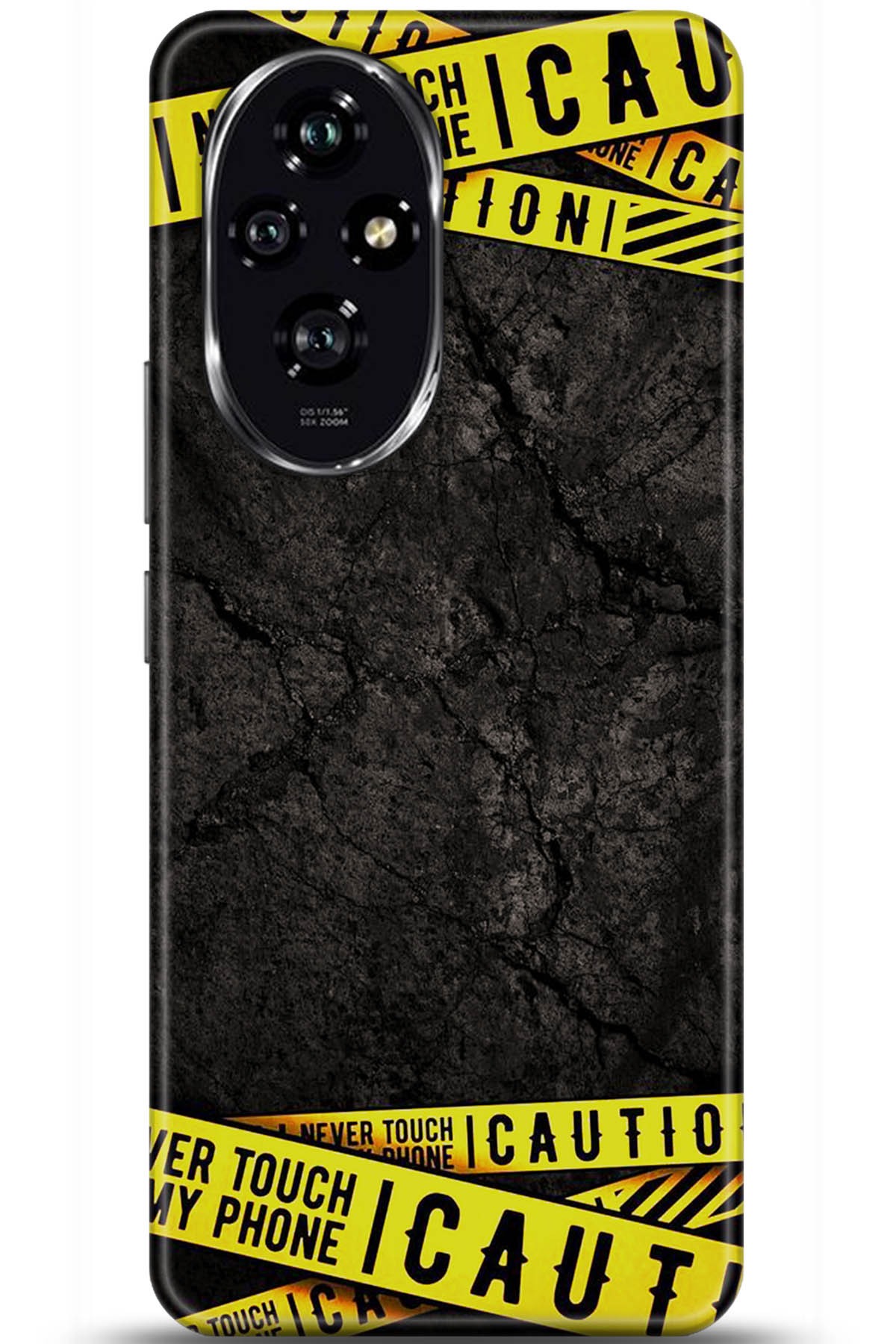 Honor 200 Uyumlu Kılıf HD Baskılı Kılıf - Followed Institution 5514