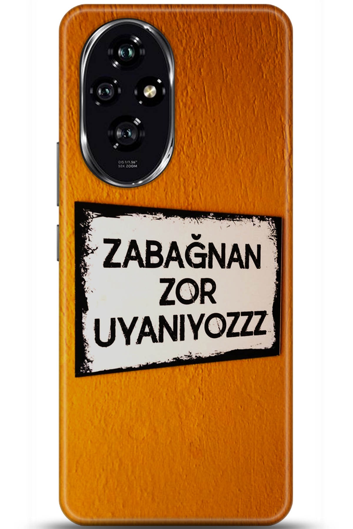 Honor 200 Uyumlu Kılıf HD Baskılı Kılıf - Followed Institution 5590