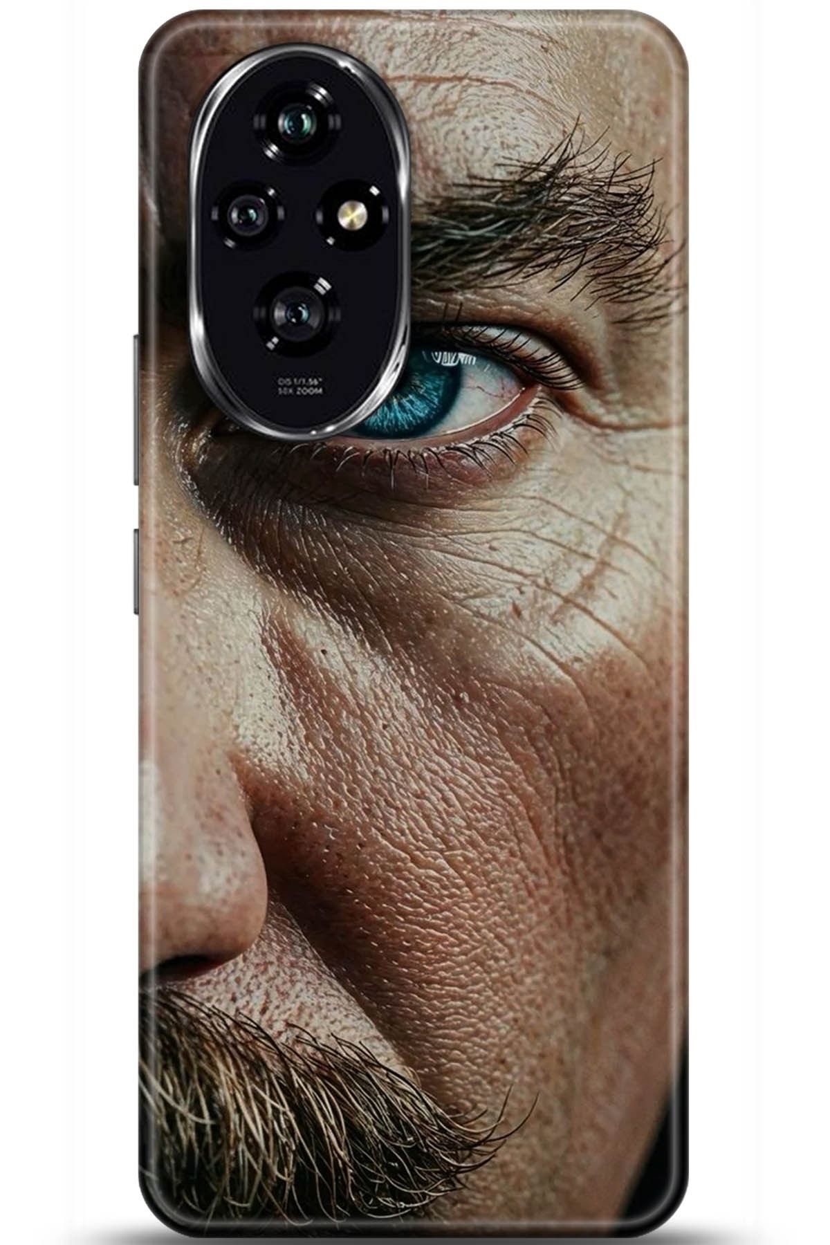 Honor 200 Uyumlu Kılıf HD Baskılı Kılıf - Followed Institution 5742