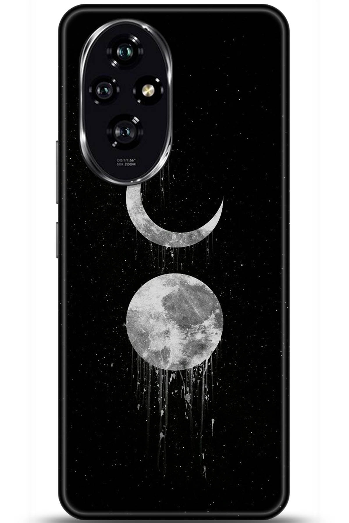 Honor 200 Uyumlu Kılıf HD Baskılı Kılıf - Followed Institution 5788