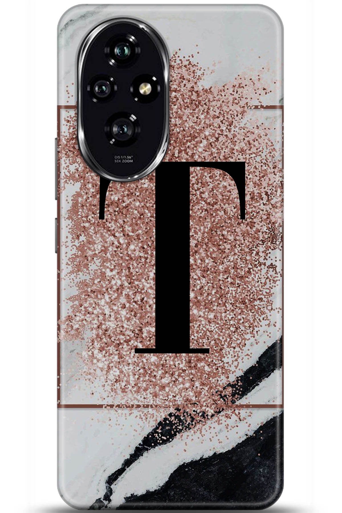 Honor 200 Uyumlu Kılıf HD Baskılı Kılıf - Followed Institution 5998