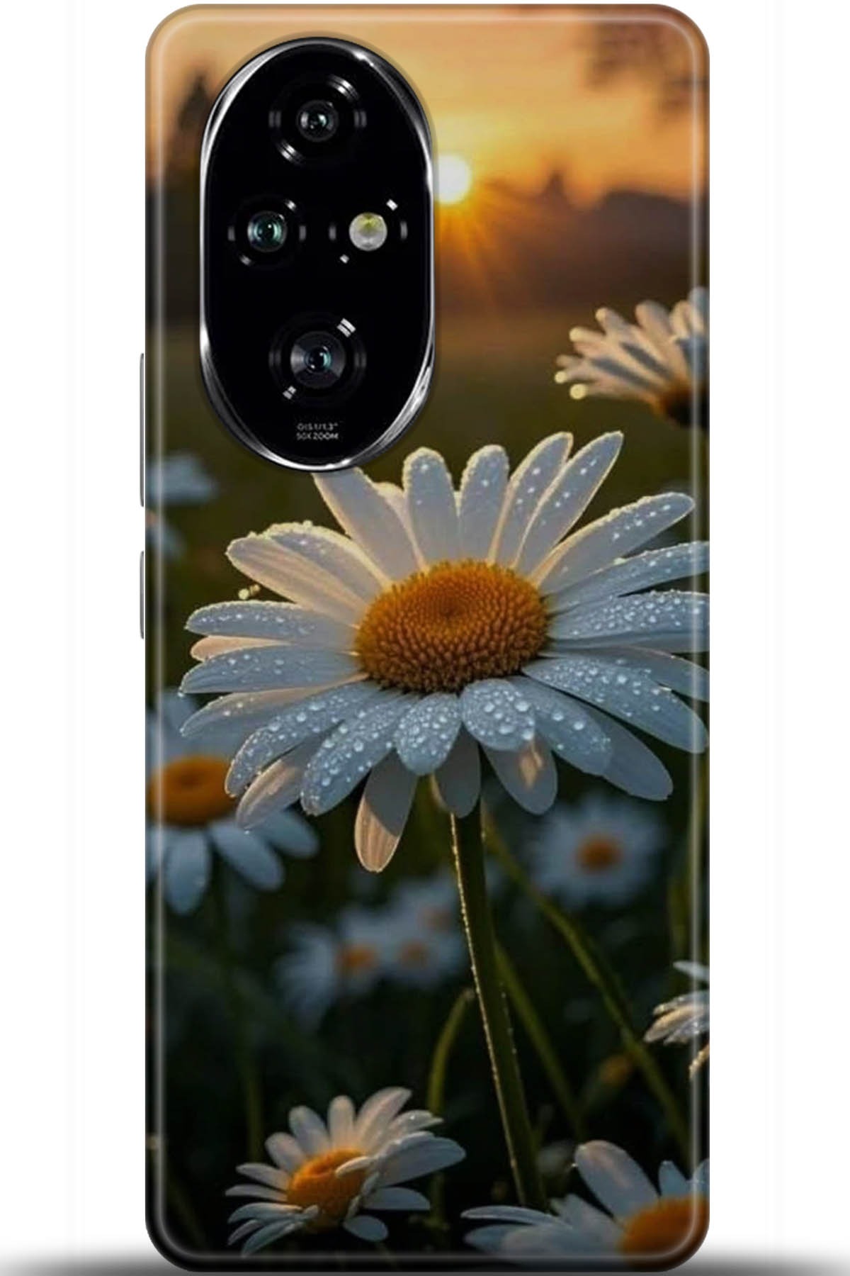 Honor 200 Pro Uyumlu Kılıf HD Baskılı Kılıf - Followed Institution 5747