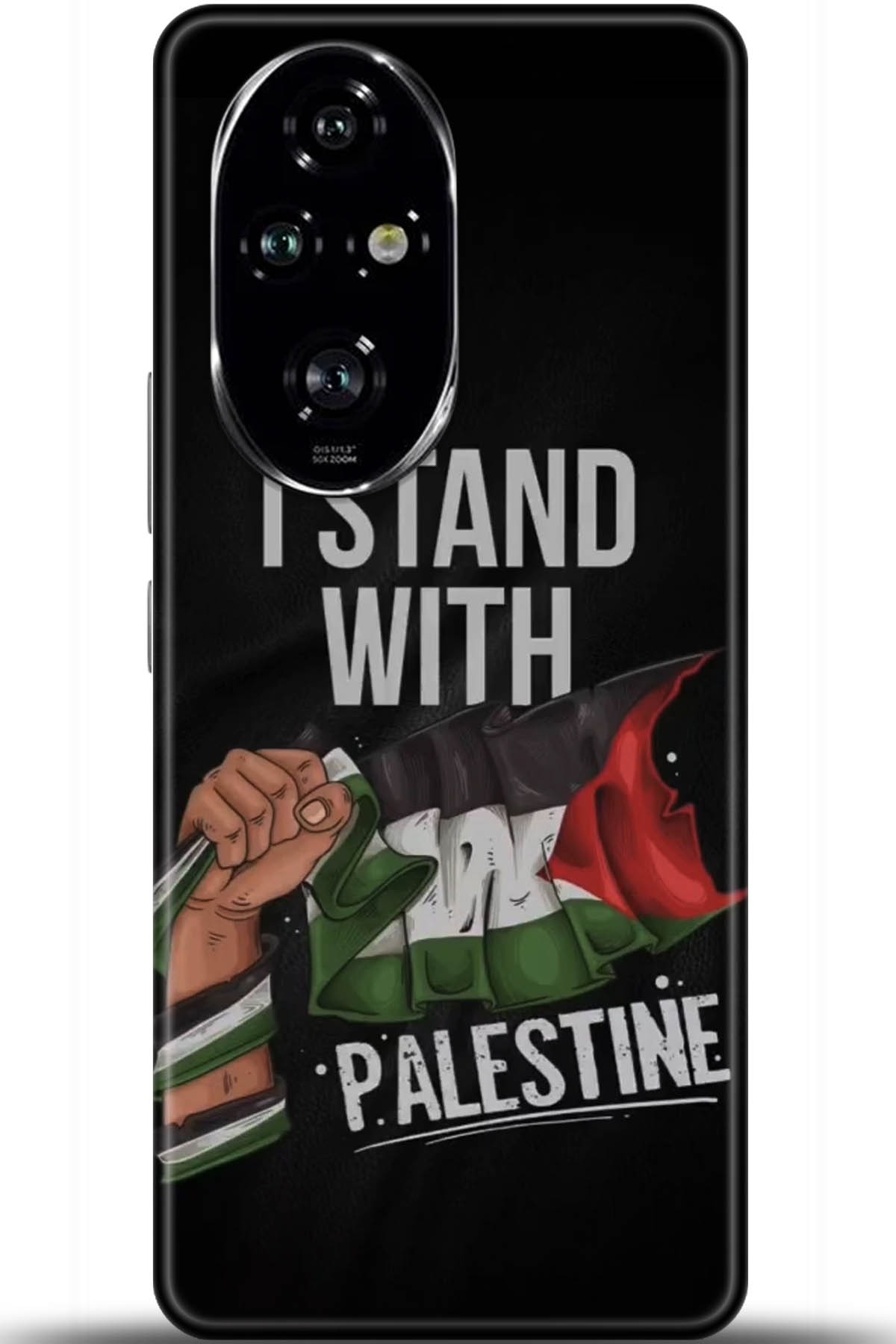 Honor 200 Pro Uyumlu Kılıf HD Baskılı Kılıf - Followed Institution 5804