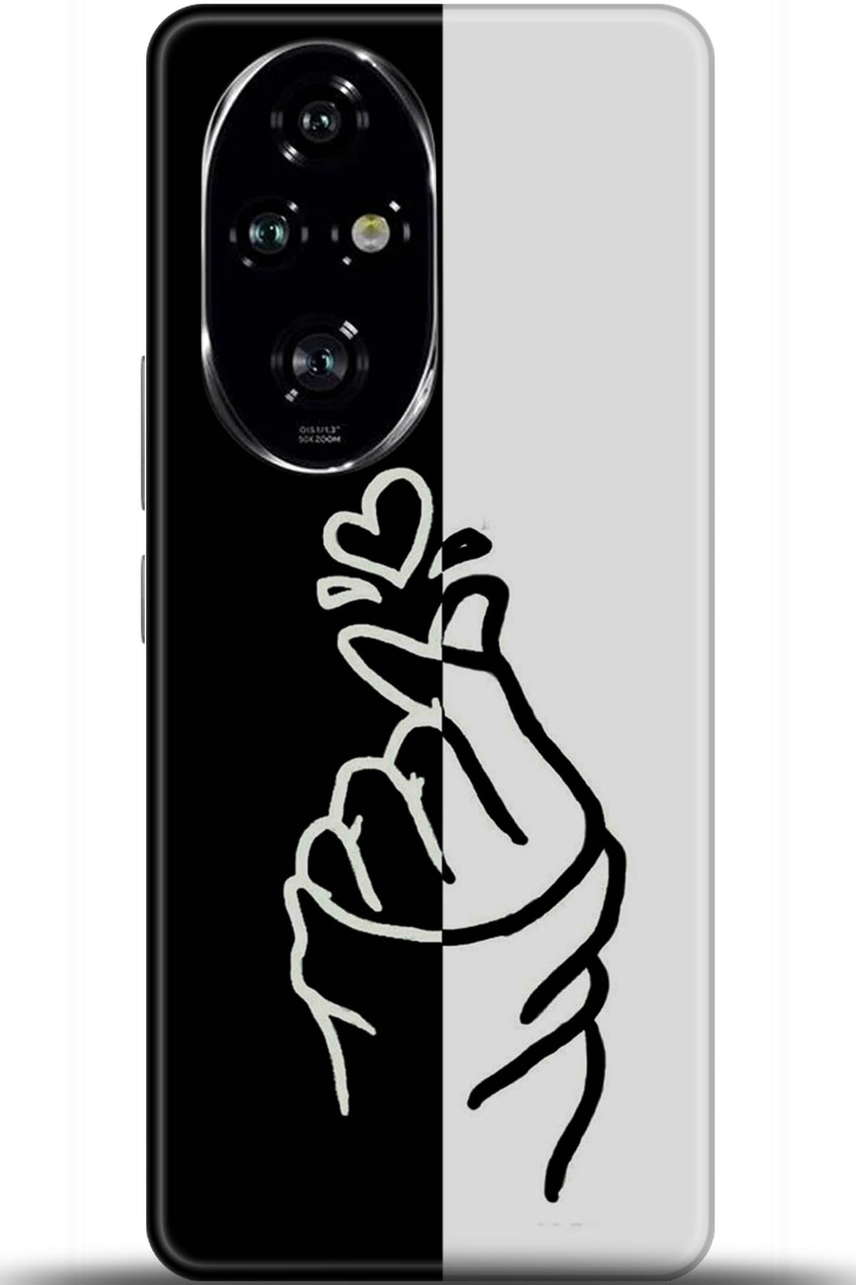 Honor 200 Pro Uyumlu Kılıf HD Baskılı Kılıf - Followed Institution 5918