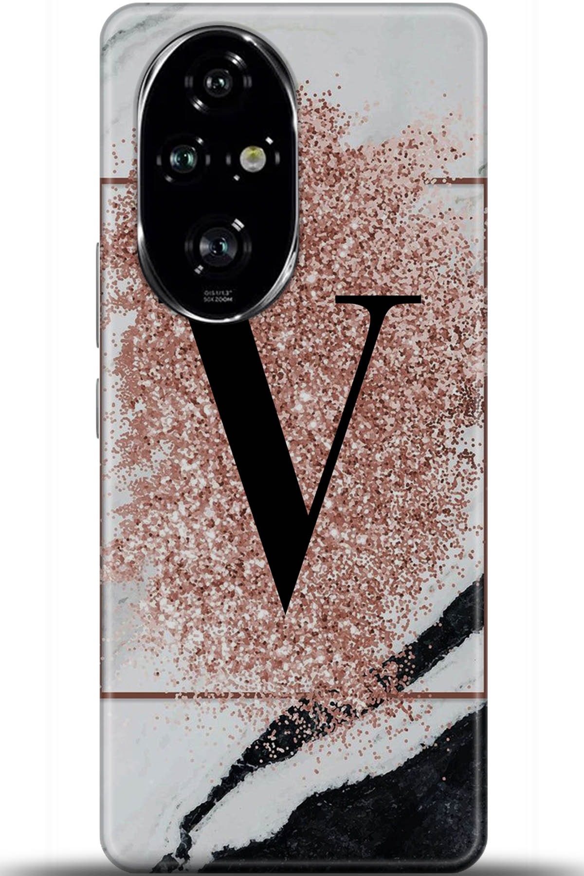 Honor 200 Pro Uyumlu Kılıf HD Baskılı Kılıf - Followed Institution 5995