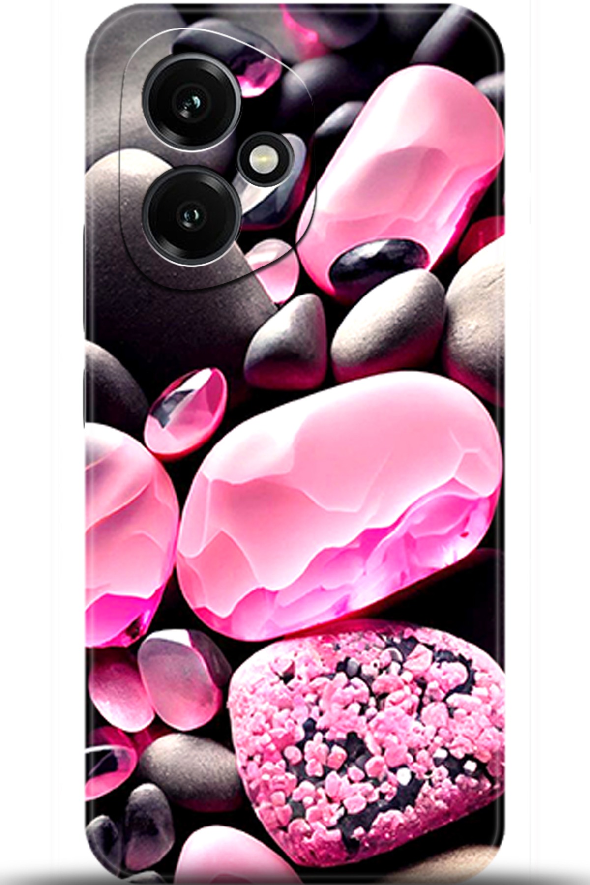 Honor 400 Uyumlu Kılıf HD Baskılı Kılıf - Followed Institution 5529