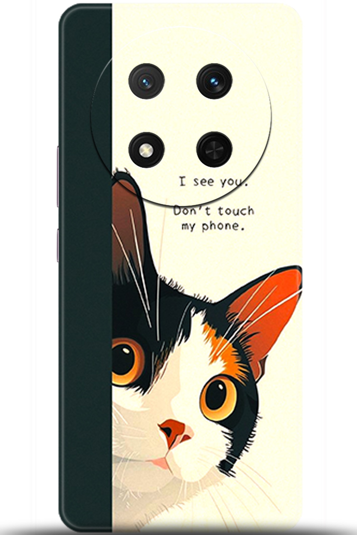 Honor Magic7 Lite Kılıf HD Baskılı Kılıf - Followed Institution 5649