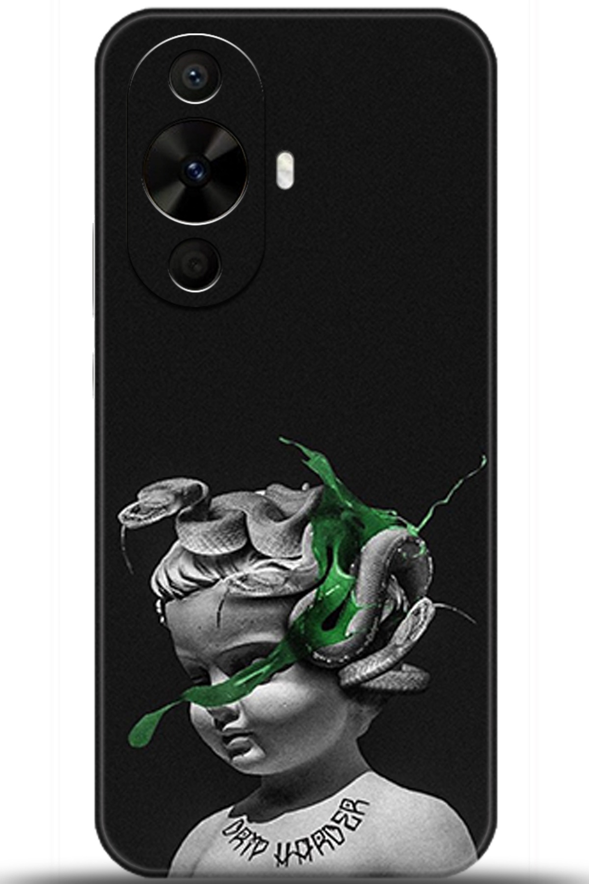 Huawei Nova 12s Uyumlu Kılıf HD Baskılı Kılıf - Followed Institution 5077