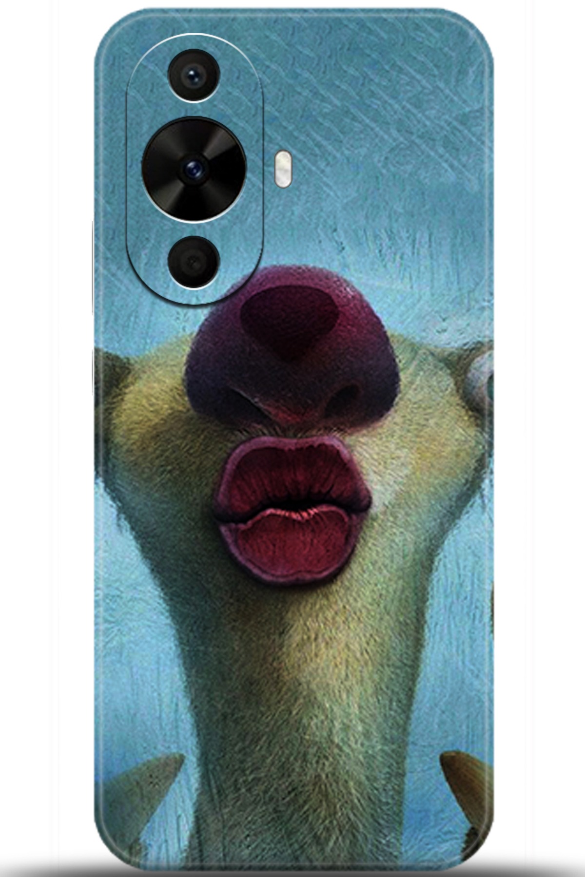 Huawei Nova 12s Uyumlu Kılıf HD Baskılı Kılıf - Followed Institution 5372