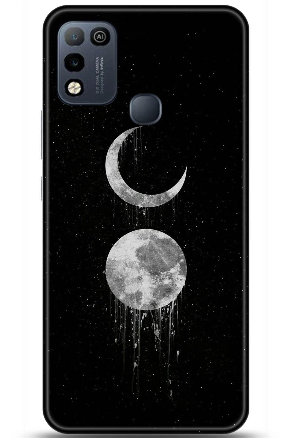 iNfinix Hot 10 Play Uyumlu Kılıf HD Baskılı Kılıf - Followed Institution 5788