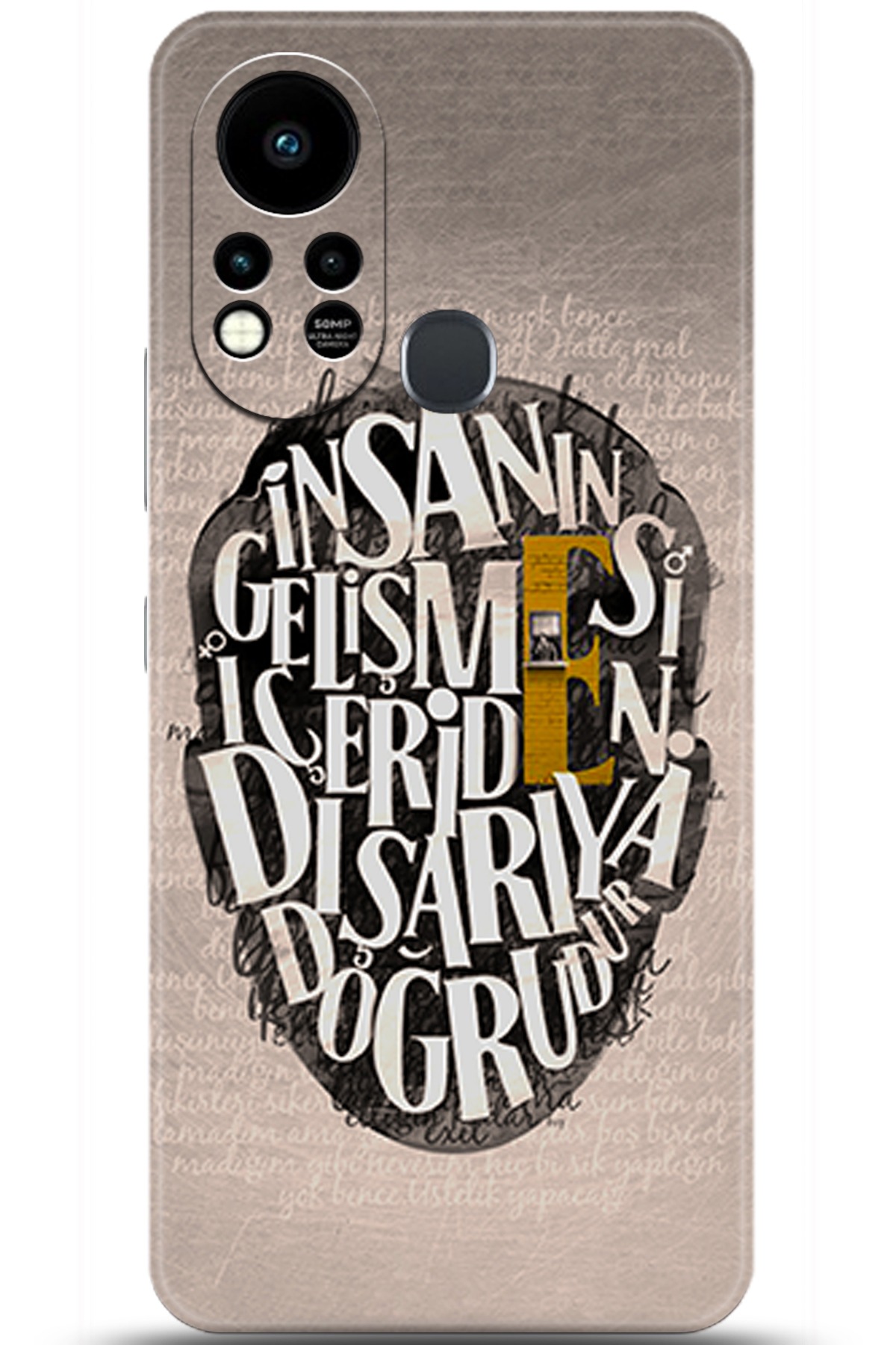 iNfinix Hot 11s Uyumlu Kılıf HD Baskılı Kılıf - Followed Institution 5587