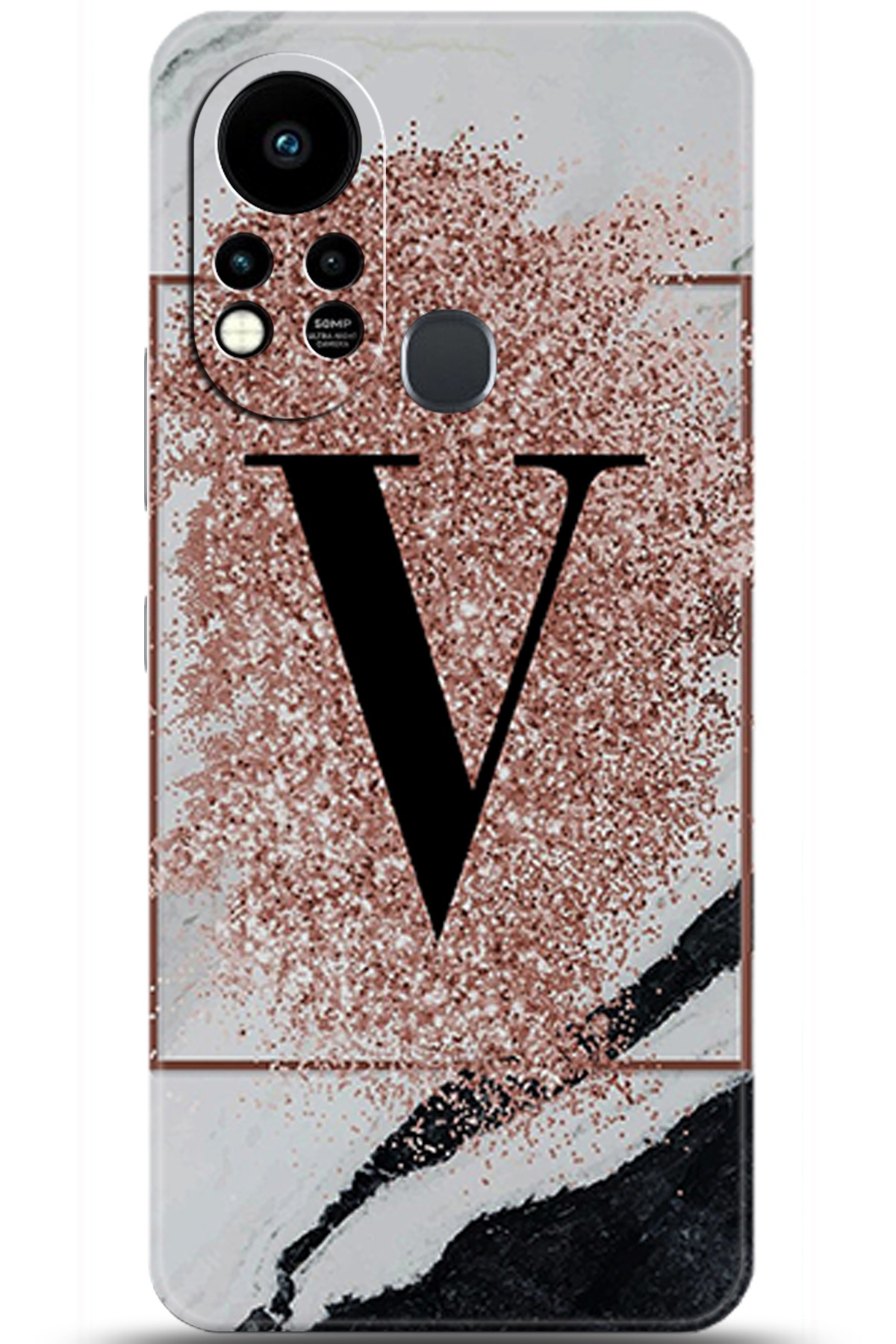 iNfinix Hot 11s Uyumlu Kılıf HD Baskılı Kılıf - Followed Institution 5995