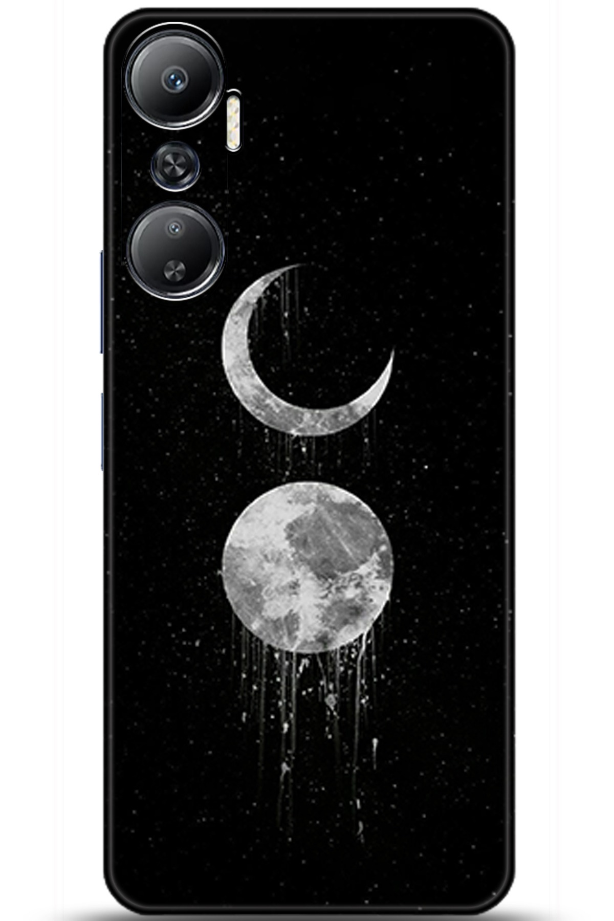 iNfinix Hot 20 Uyumlu Kılıf HD Baskılı Kılıf - Followed Institution 5788