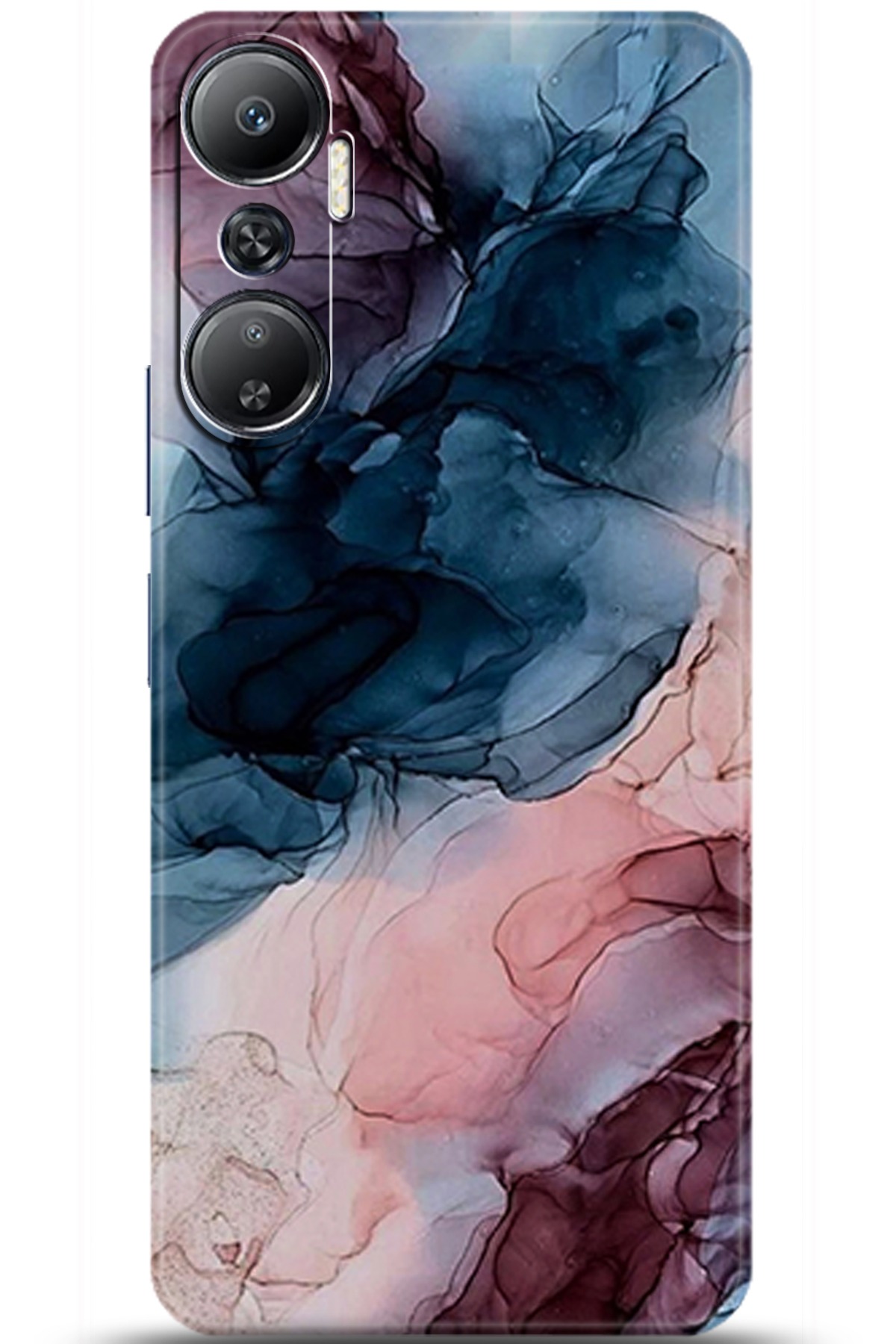 iNfinix Hot 20 Uyumlu Kılıf HD Baskılı Kılıf - Followed Institution 5985