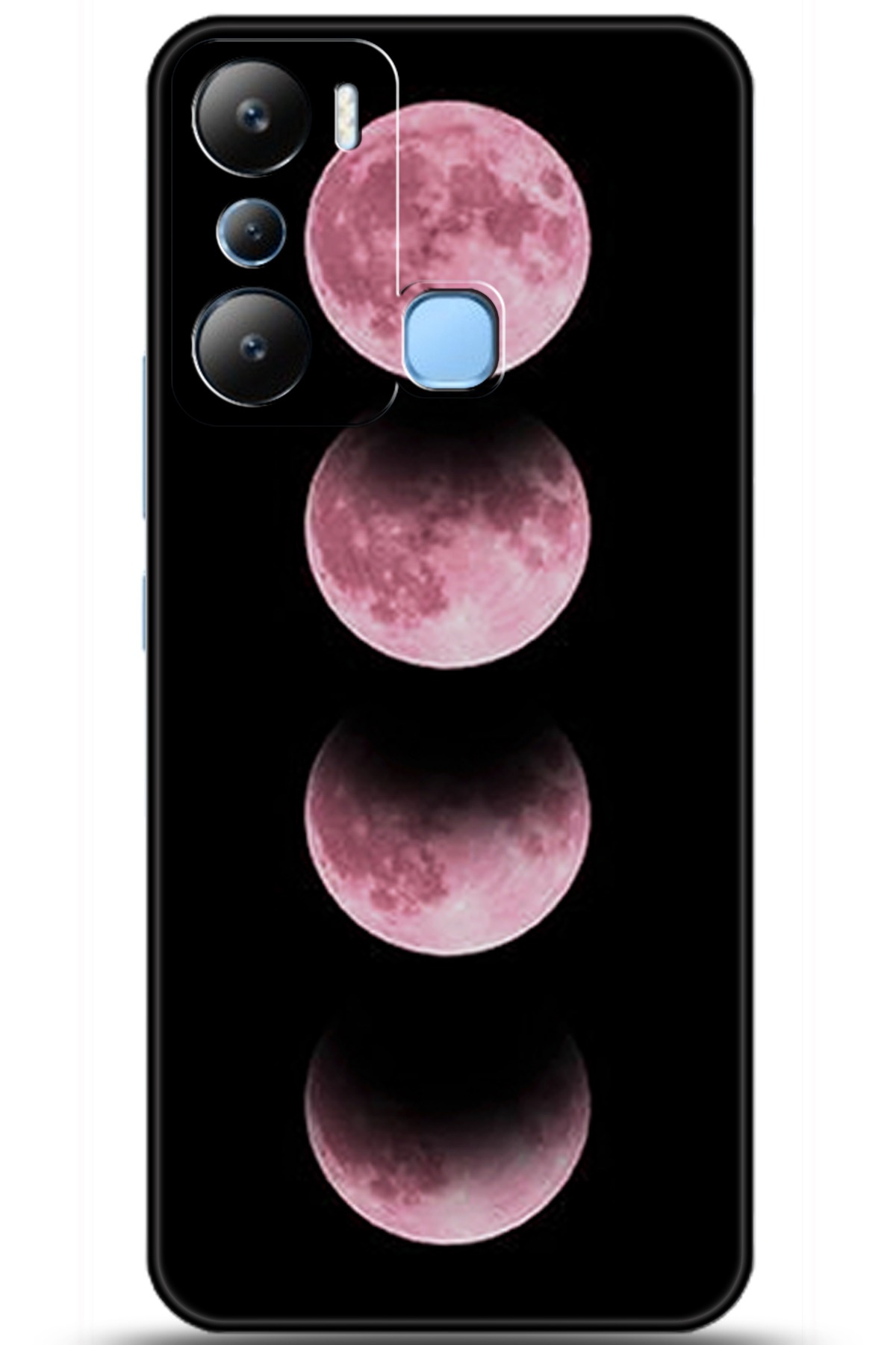 iNfinix Hot 20i Uyumlu Kılıf HD Baskılı Kılıf - Followed Institution 5915