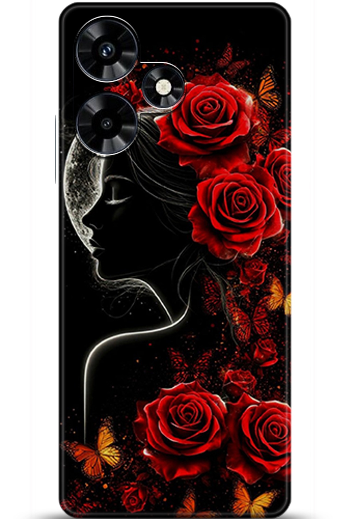 iNfinix Hot 30 Uyumlu Kılıf HD Baskılı Kılıf - Followed Institution 5863