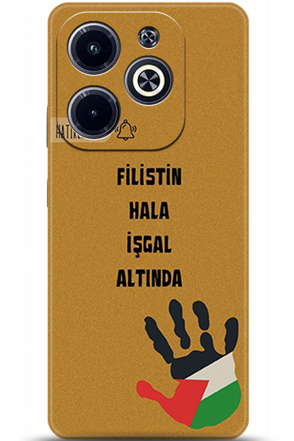 iNfinix Hot 40i Uyumlu Kılıf HD Baskılı Kılıf - Followed Institution 5740