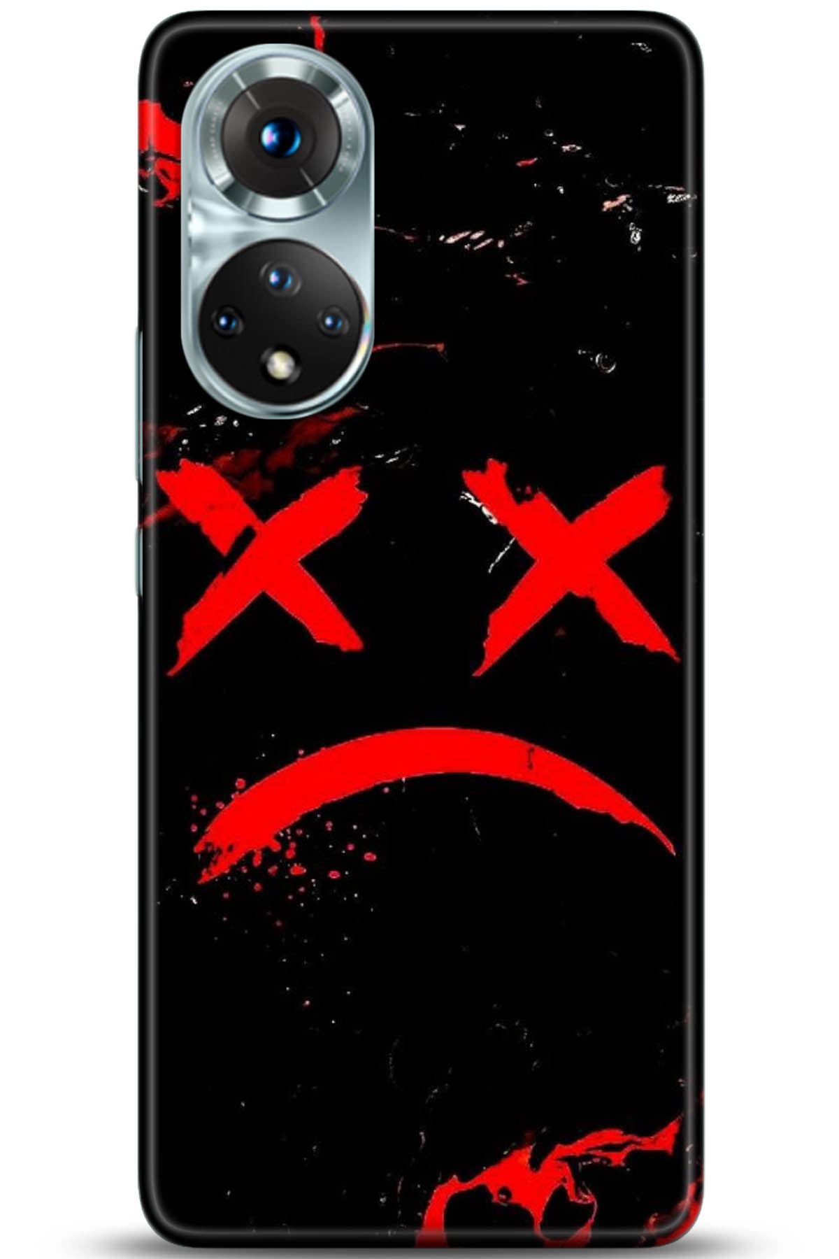 Honor 50 Kılıf HD Baskılı Kılıf - Followed Institution 5139