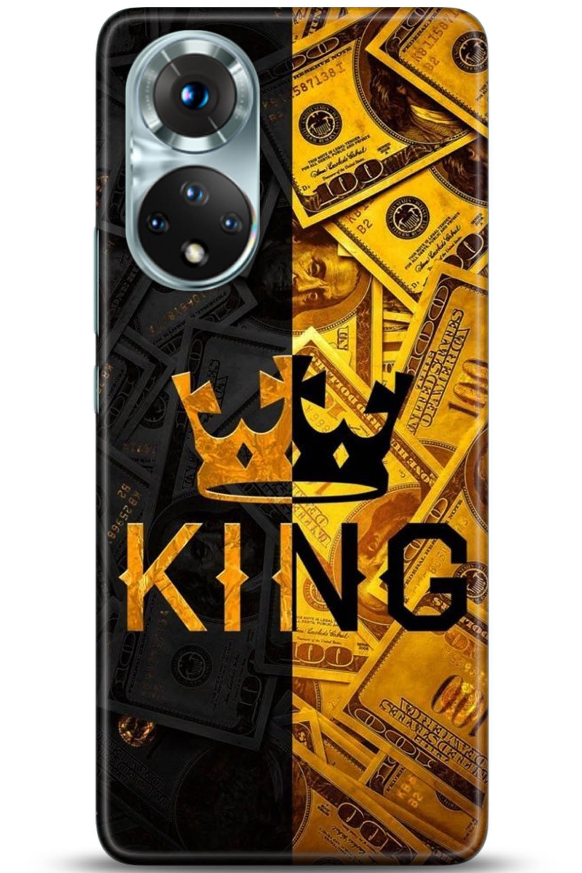 Honor 50 Kılıf HD Baskılı Kılıf - Followed Institution 5223