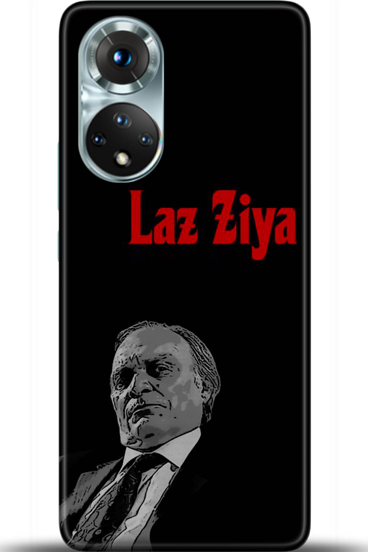 Honor 50 Kılıf HD Baskılı Kılıf - Followed Institution 5387