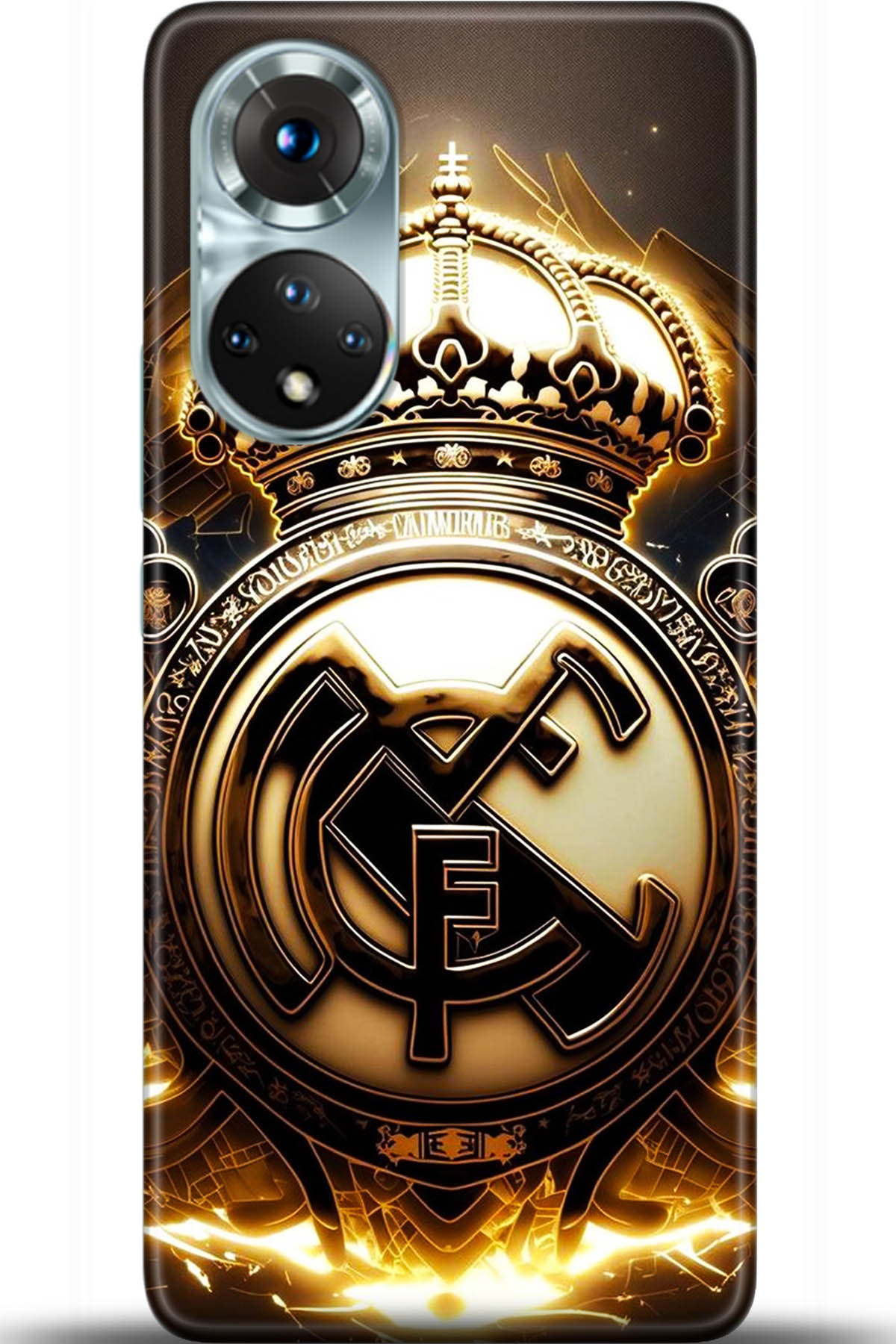 Honor 50 Kılıf HD Baskılı Kılıf - Followed Institution 5395