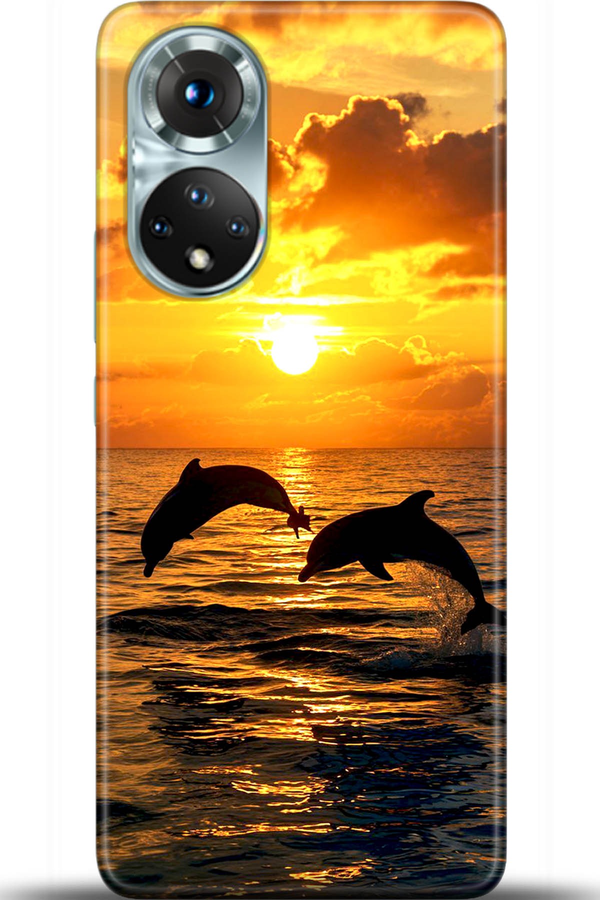 Honor 50 Kılıf HD Baskılı Kılıf - Followed Institution 5427