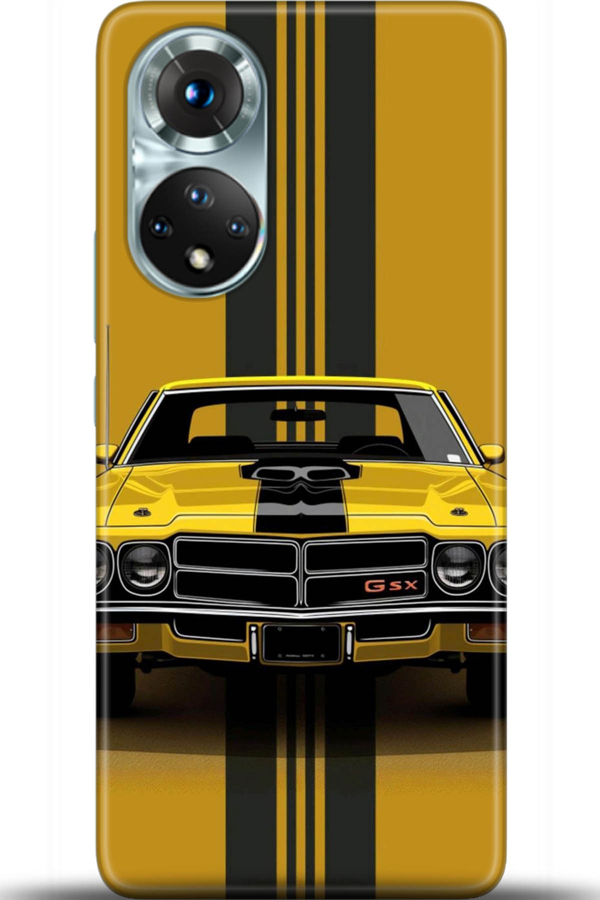 Honor 50 Kılıf HD Baskılı Kılıf - Followed Institution 5461