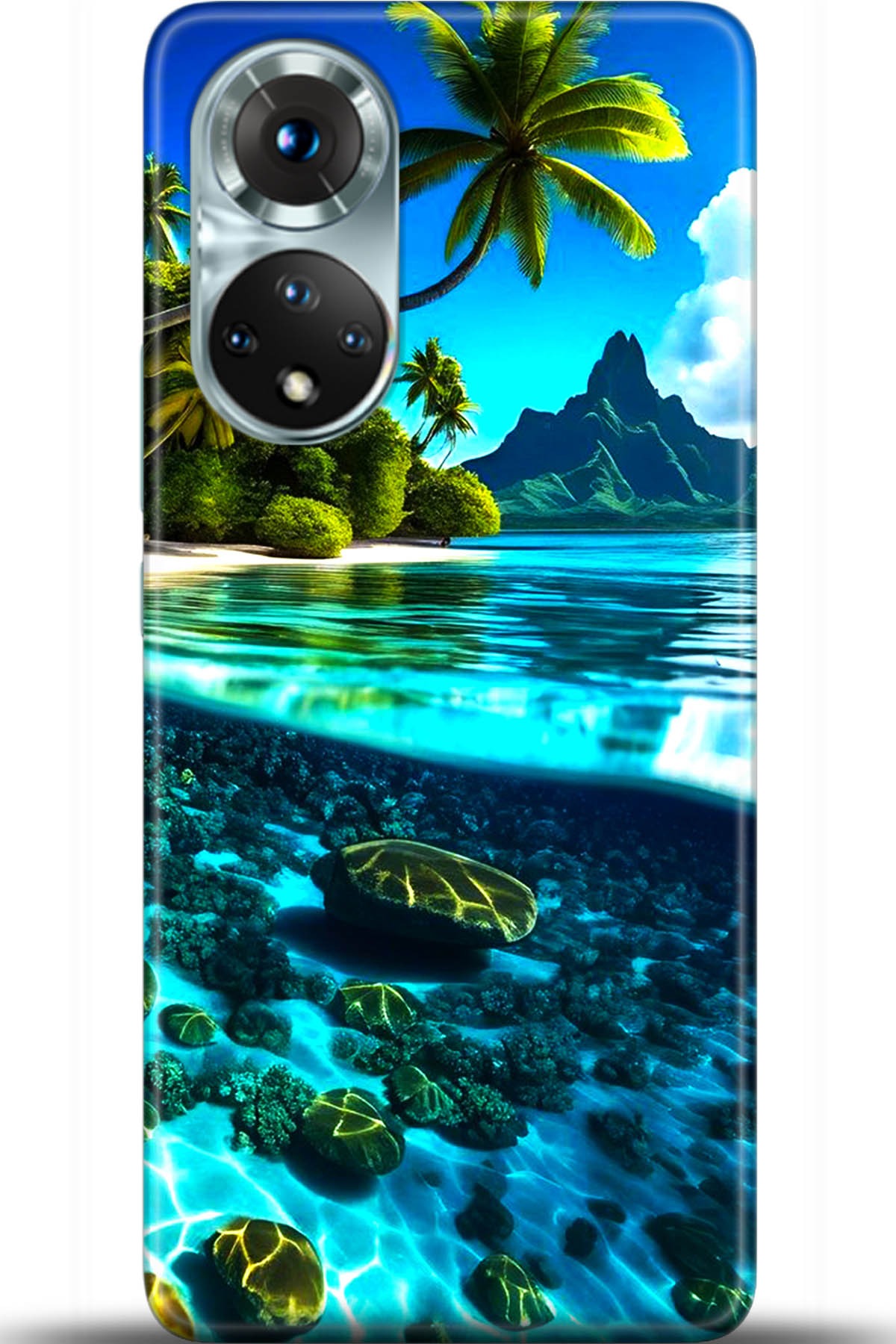 Honor 50 Kılıf HD Baskılı Kılıf - Followed Institution 5491