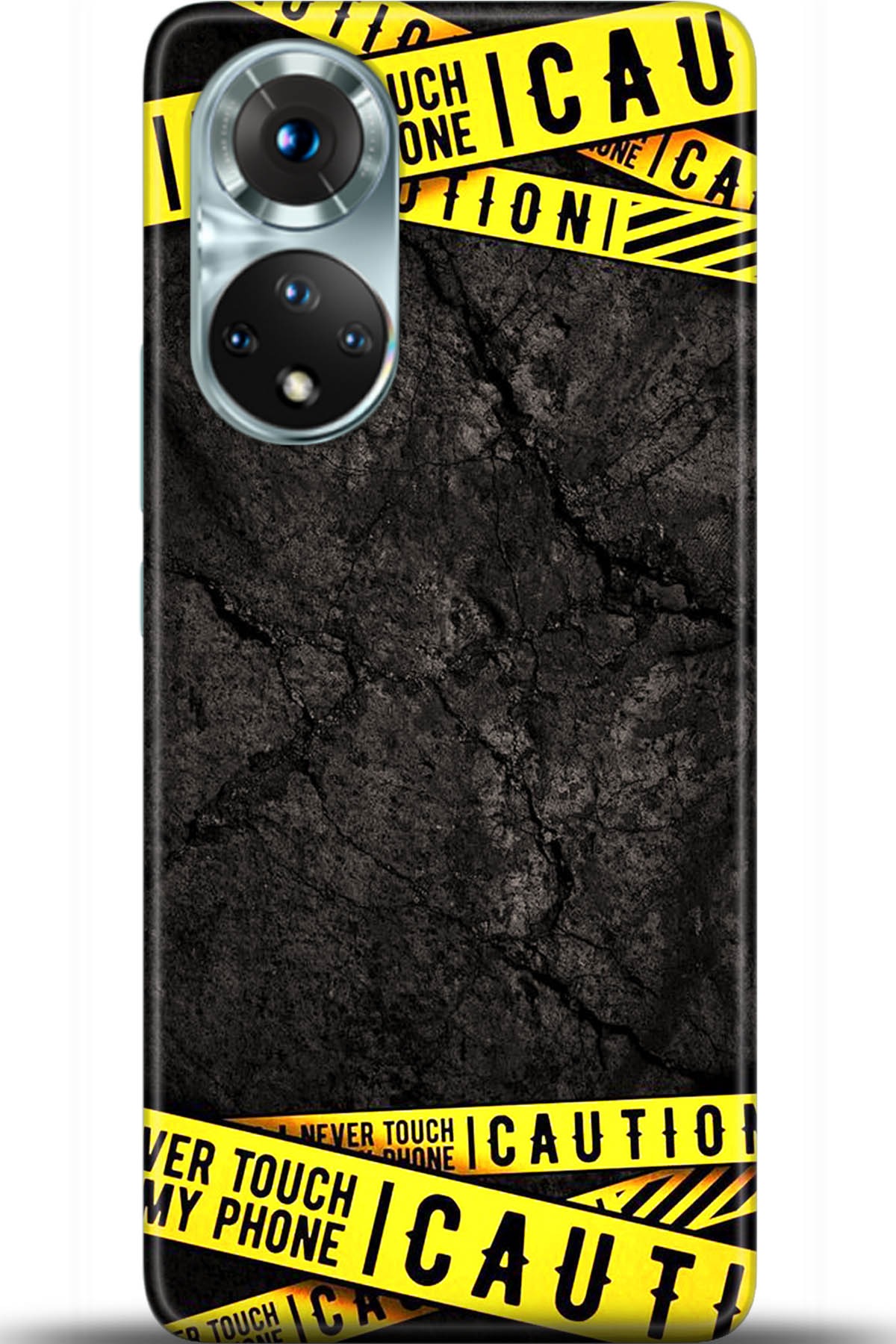 Honor 50 Kılıf HD Baskılı Kılıf - Followed Institution 5514