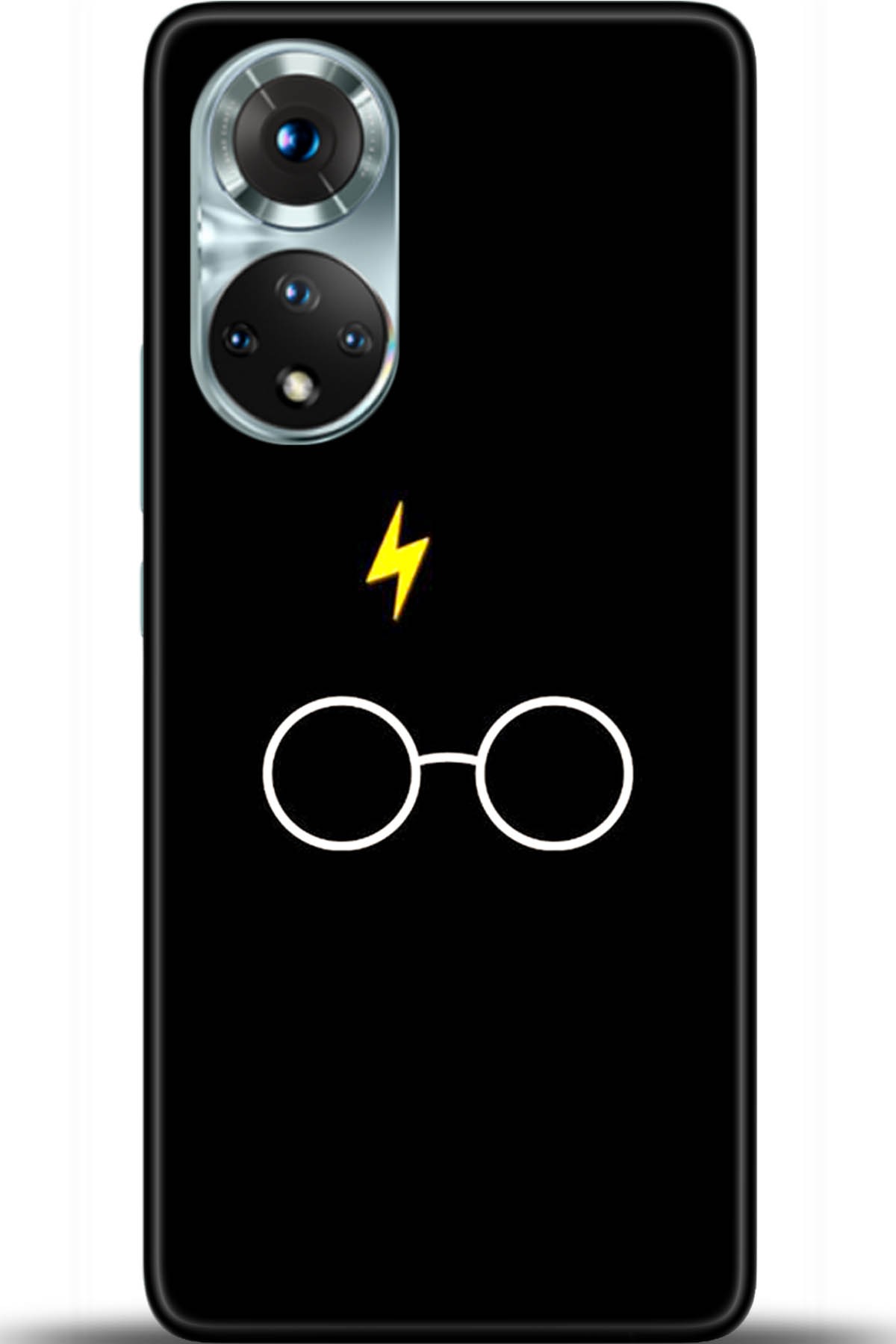 Honor 50 Kılıf HD Baskılı Kılıf - Followed Institution 5550